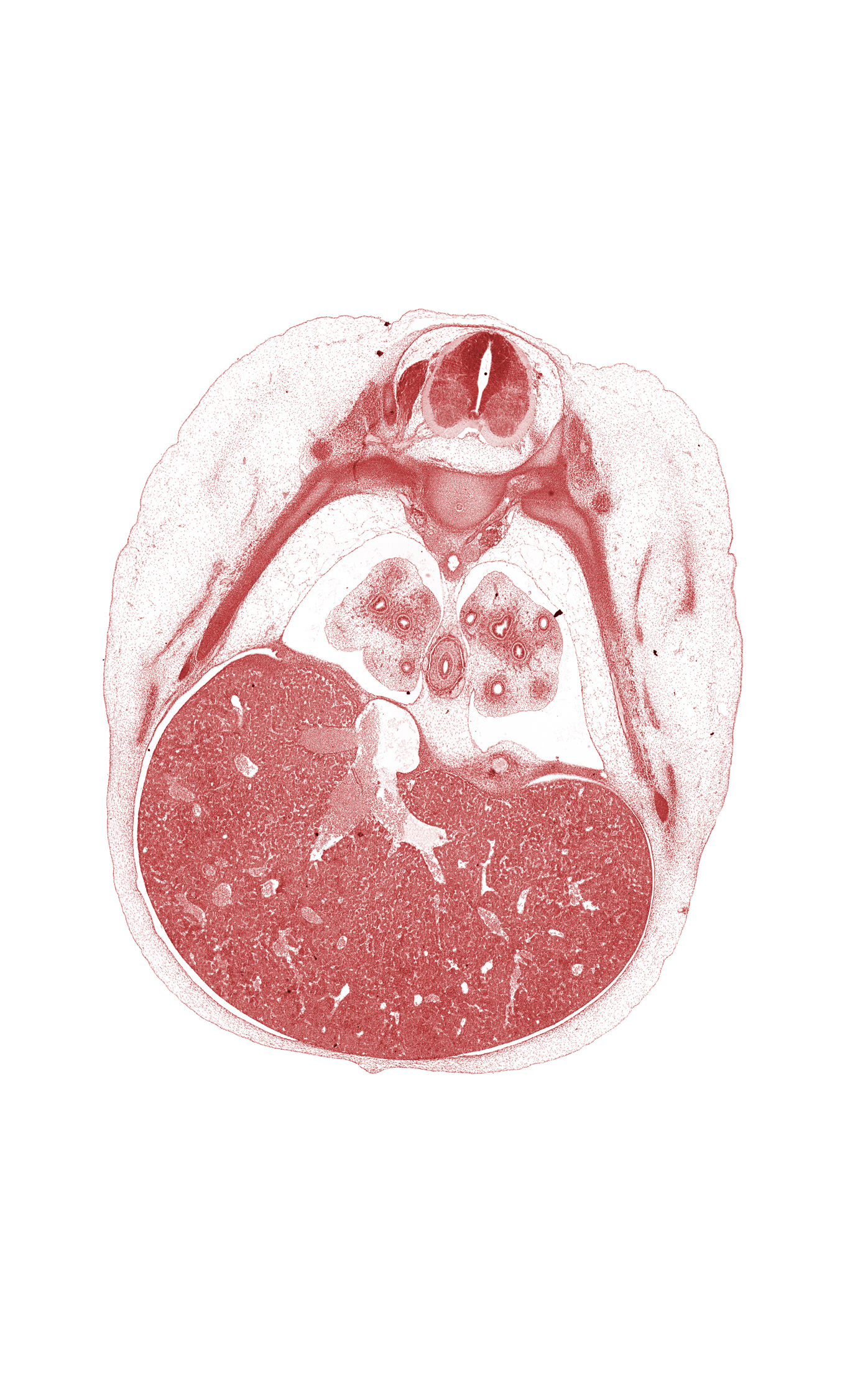 T-6 / T-7 interganglion region, T-7 intercostal nerve, anterior medial basal tertiary bronchus, aorta, central tendon of diaphragm, cephalic edge of umbilical cord, common efferent hepatic vein, inferior vena cava, left lobe of liver, lower lobe of left lung, pulmogenic coat, rib 7, rib 8, right lobe of liver, subarachnoid space, surface ectoderm, sympathetic trunk