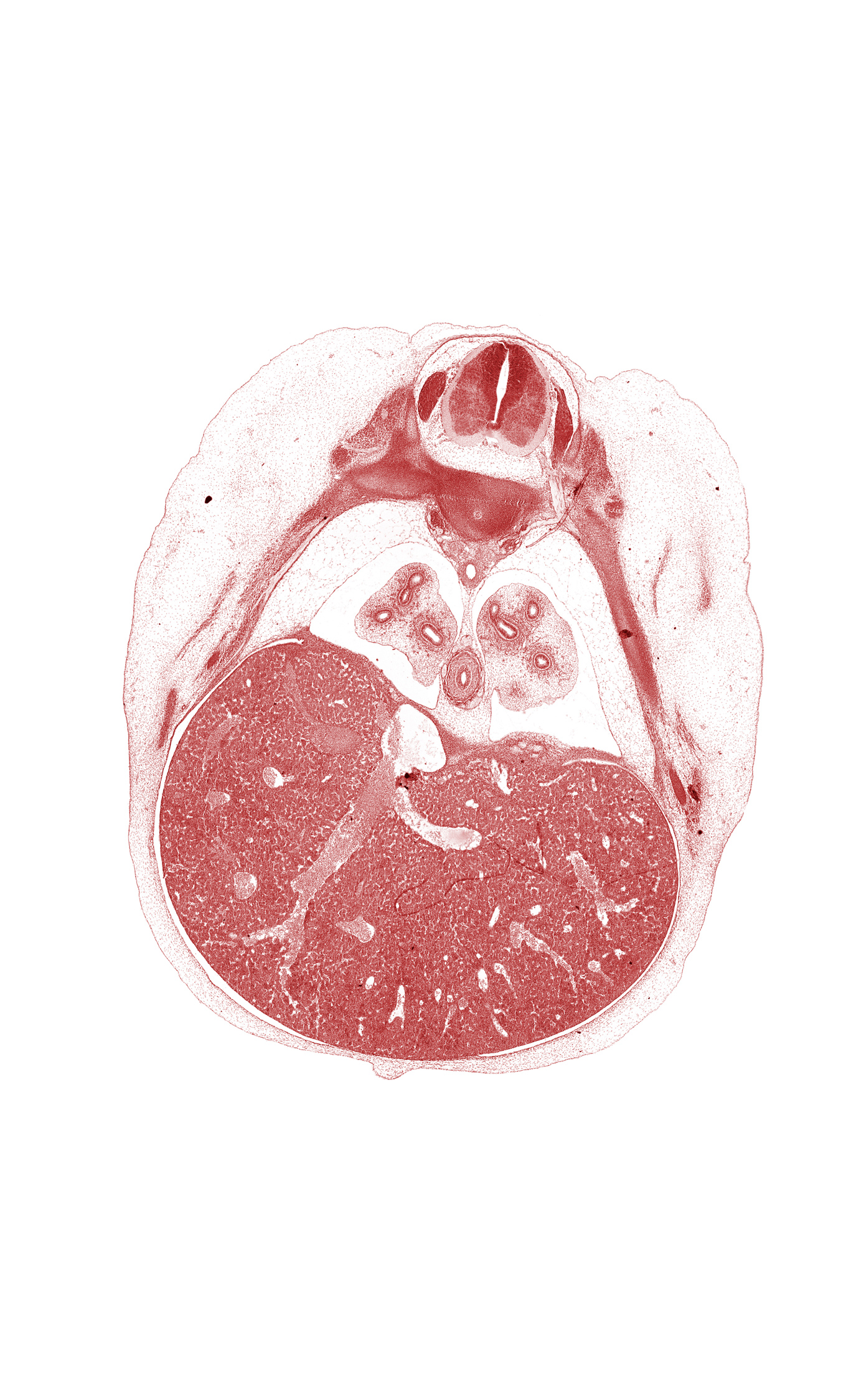 T-7 / T-8 intervertebral disc, T-7 intercostal nerve, T-7 spinal ganglion, blastemata of deep back muscles, efferent hepatic veins, esophagus, inferior vena cava, liver prominence, lower lobe of left lung, notochord, osteogenic layer, peritoneal cavity, pleural cavity, pleuroperitoneal membrane, rib 7, rib 8, sympathetic trunk, umbilical cord