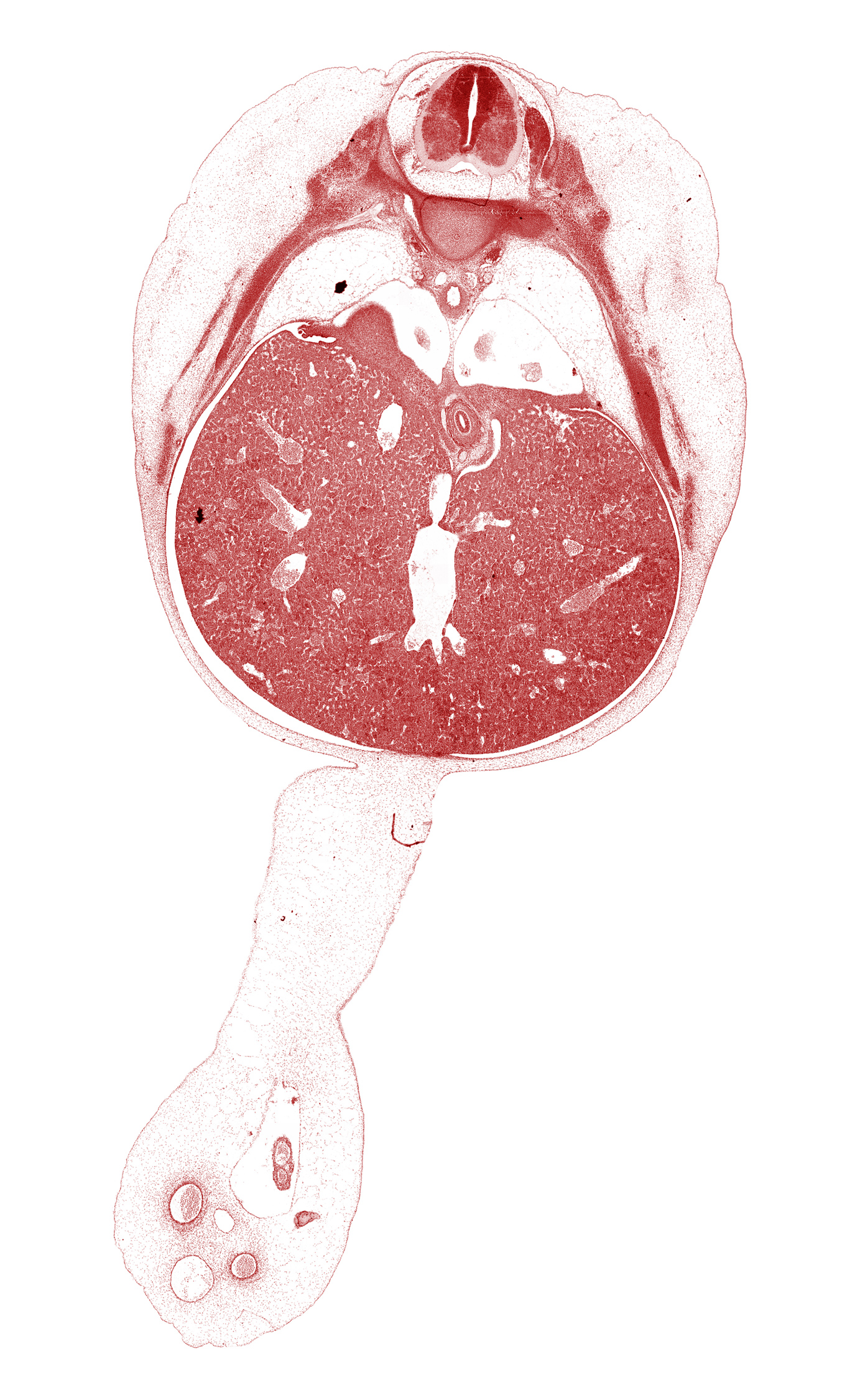 T-8 spinal ganglion, caudal edge of left lung, ductus venosus, esophagus, head of rib 9, inferior vena cava, lung, right, mucoid connective tissue in umbilical cord, omphalomesenteric artery, peritoneal cavity, postcardinal vein, rib 10, rib 9, suprarenal gland cortex, umbilical coelom