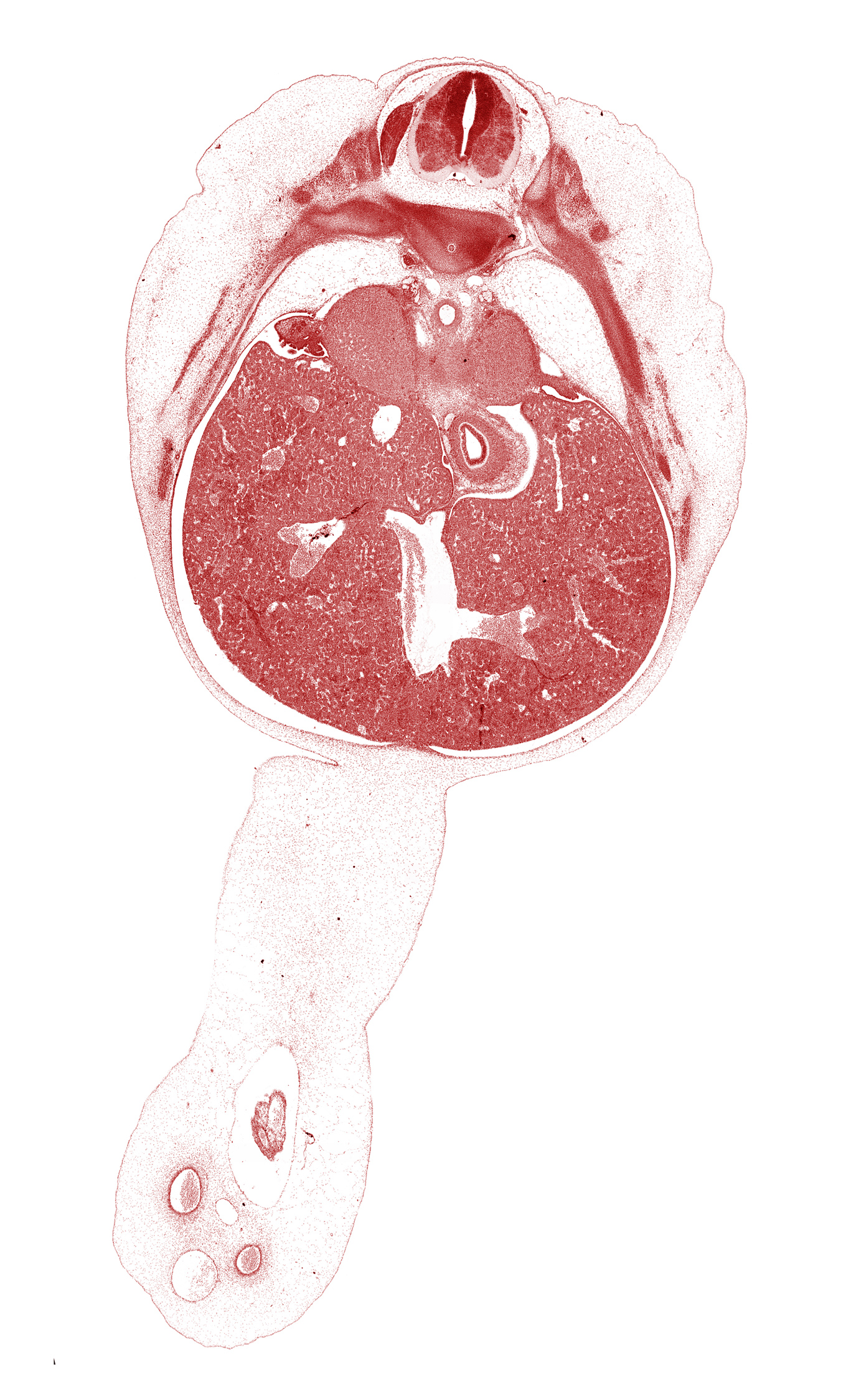 T-8 / T-9 interganglion region, T-9 / T-10 intervertebral disc, T-9 intercostal nerve, afferent hepatic vein, amnion on surface of umbilical cord, aorta, blastemata of deep back muscles, ductus venosus, falciform ligament, inferior vena cava, junction of esophagus and stomach, left lobe of liver, omphalomesenteric artery, rib 10, rib 11, right lobe of liver, sympathetic trunk, umbilical coelom