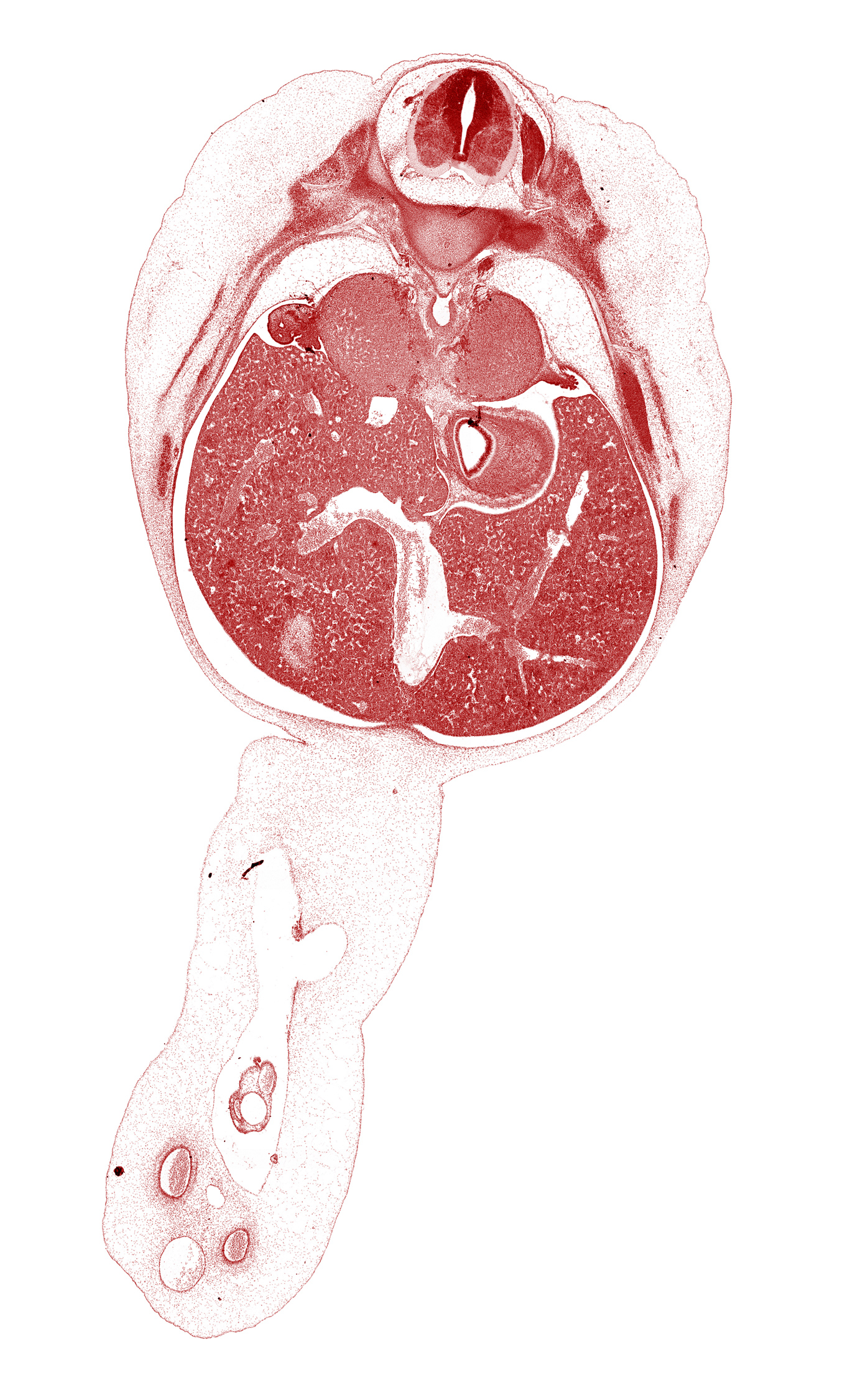 T-9 intercostal nerve, T-9 spinal ganglion, afferent hepatic vein, aorta, celiac ganglion, cephalic edge of gall bladder, cephalic edge of herniated midgut, ductus venosus, falciform ligament, fundus of stomach, head of rib 10, inferior vena cava, omphalomesenteric artery, posterior intercostal artery, rib 10, suprarenal gland cortex, umbilical coelom