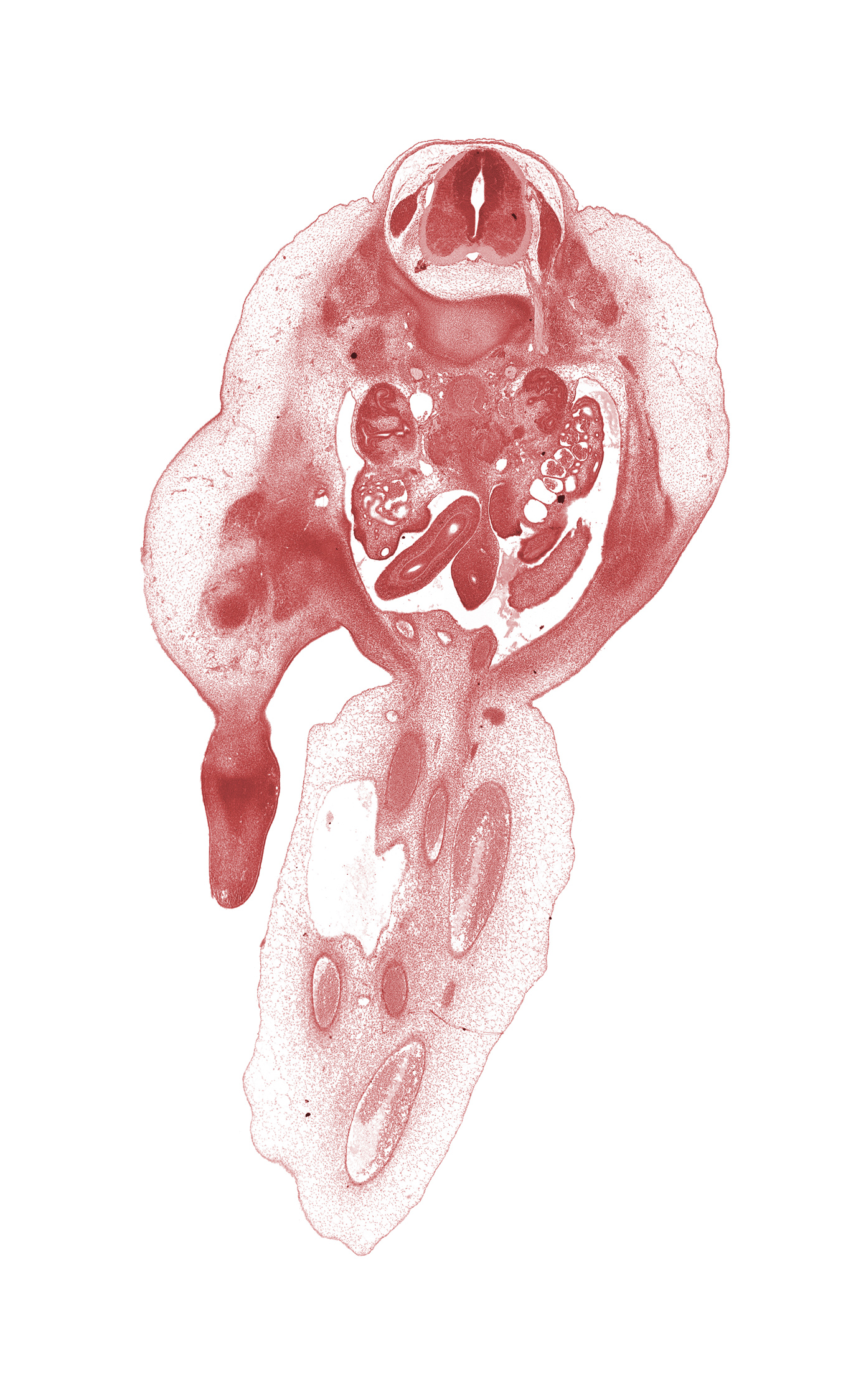 L-1 spinal ganglion, L-1 spinal nerve, allantois, apex of urinary bladder, caudal edge of mesogastrium, duodenum (fourth part), hindgut, inferior vena cava, kidney (metanephros), left umbilical artery, mesonephric duct, mesonephros, ovary, peritoneal cavity, proximal limb of midgut, right umbilical artery, umbilical coelom, umbilical vein