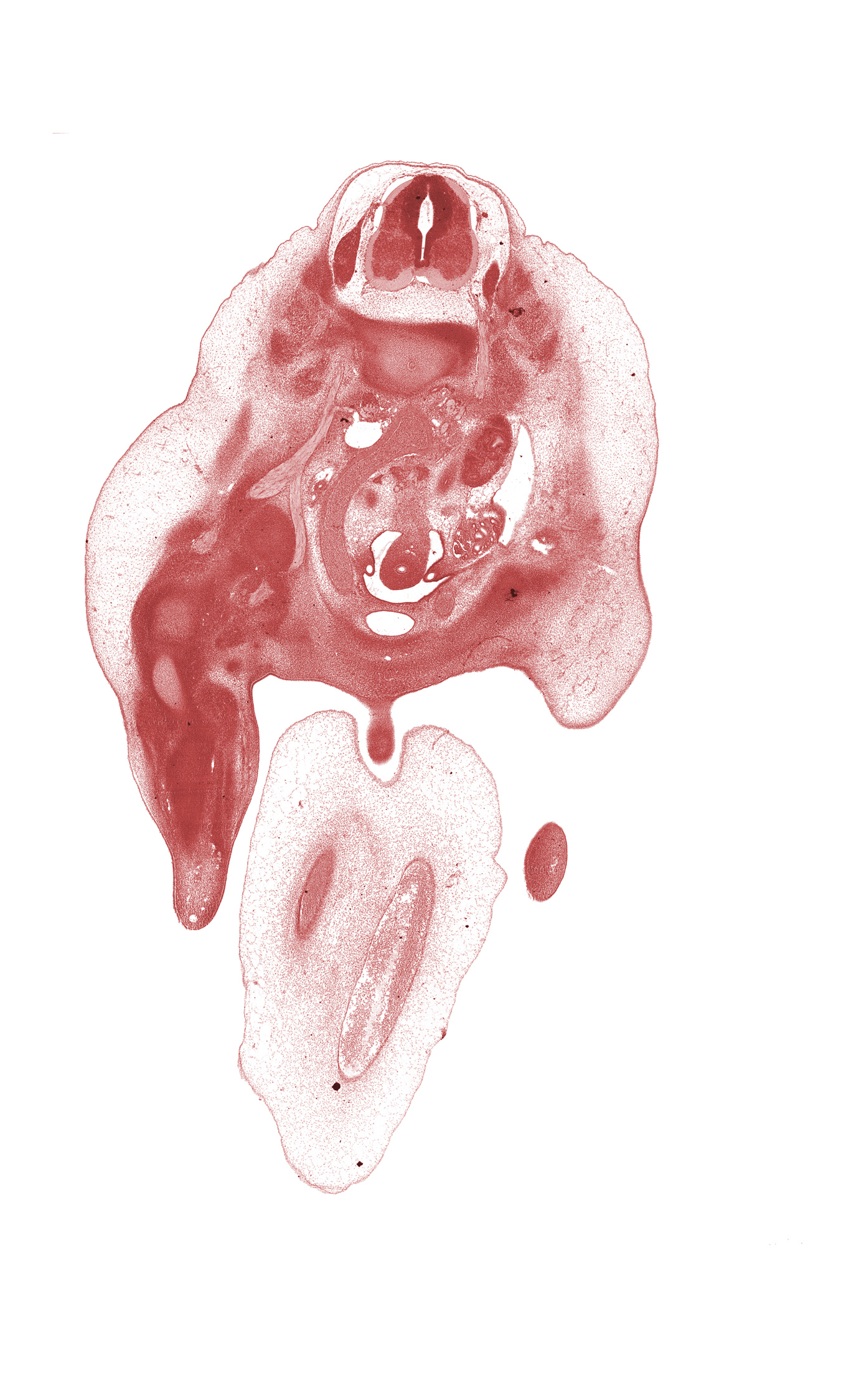 L-2 / L-3 intervertebral disc, L-2 spinal ganglion, L-2 spinal nerve, aortic bifurcation, blastemata of deep back muscles, central canal, cephalic edge of lower limb, edge of glans clitoris, edge of right umbilical artery, femoral nerve, femoral plexus, femur, hindgut, inferior mesenteric artery, kidney (metanephros), knee joint, mesonephric duct, mesonephros, obturator nerve, right common iliac artery, right umbilical artery, tibia, umbilical vein, ureter, urinary bladder