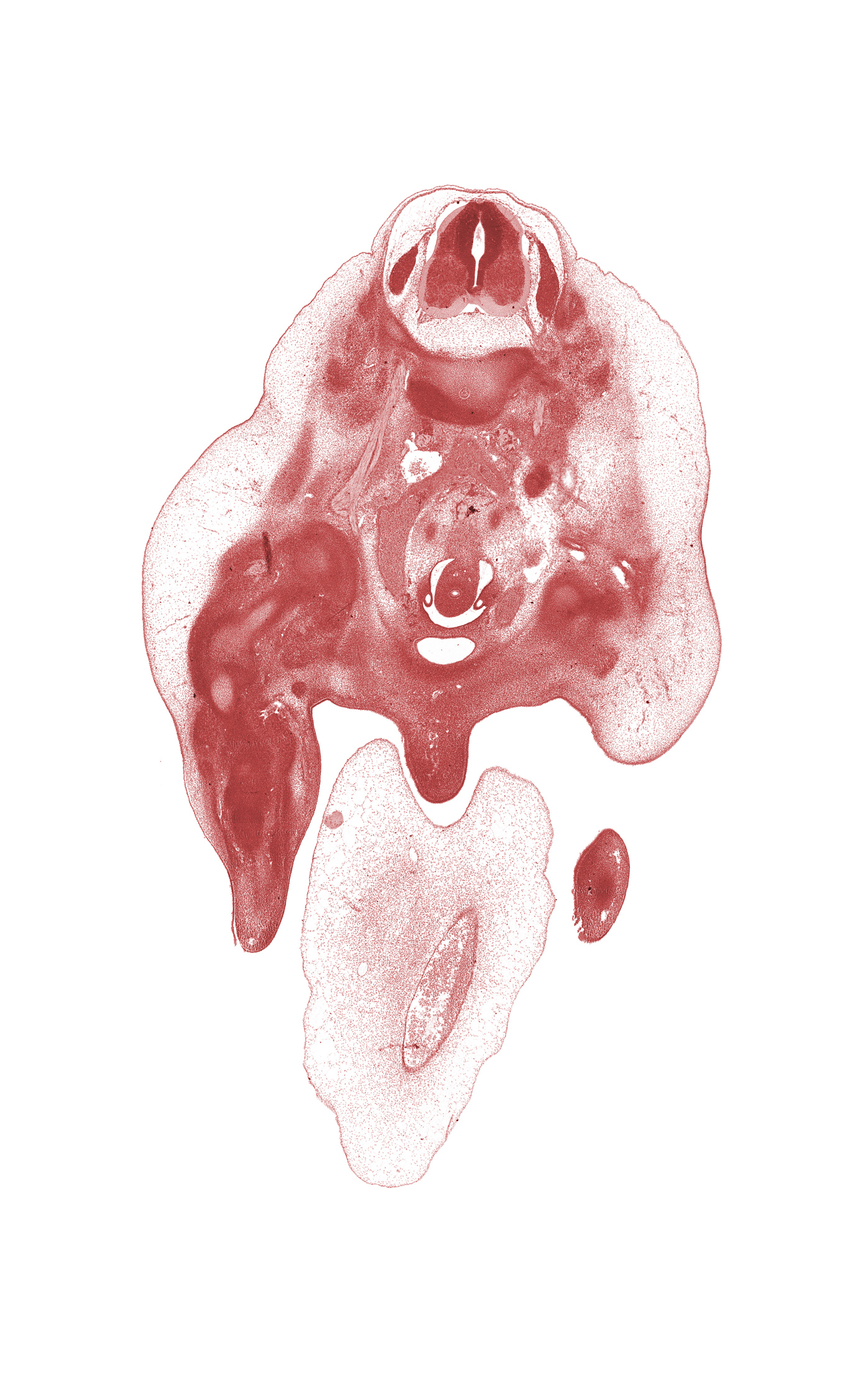 L-2 spinal ganglion, aortic bifurcation, caudal edge of kidney (metanephros), external iliac artery, femur, glans clitoris, hindgut, inferior vena cava, left ureter, marginal vein, mesonephric duct, primordial phallus, right common iliac artery, right ureter, subarachnoid space, umbilical cord, umbilical vein, urinary bladder