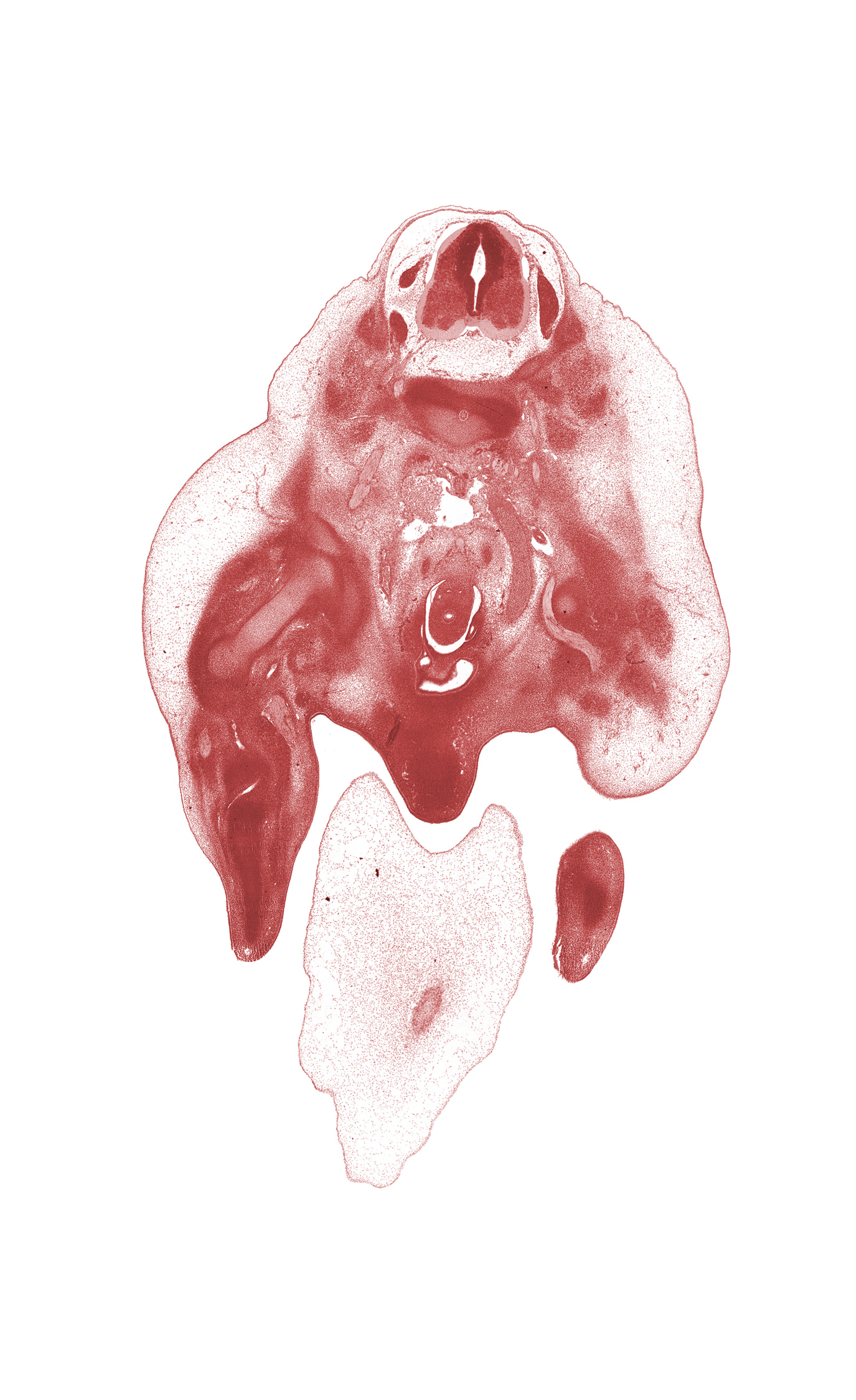 L-2 spinal ganglion, amnion on surface of umbilical cord, caudalmost section through umbilical vein, central canal, femur, glans clitoris, hindgut, left common iliac artery, left horn of urinary bladder, left umbilical artery, left ureter, median sacral nerve, mesonephric duct, osteogenic layer, primordial phallus, right ureter, surface ectoderm