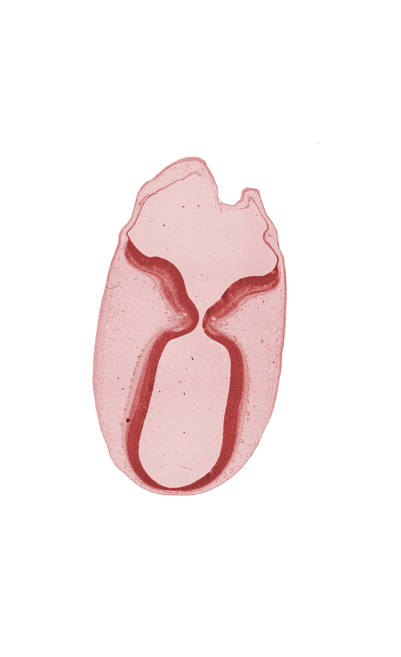 head mesenchyme, isthmus of metencephalon, roof plate, root of trochlear nerve (CN IV), subarachnoid space, surface ectoderm, tectum of mesencephalon (M2), vascular plexus