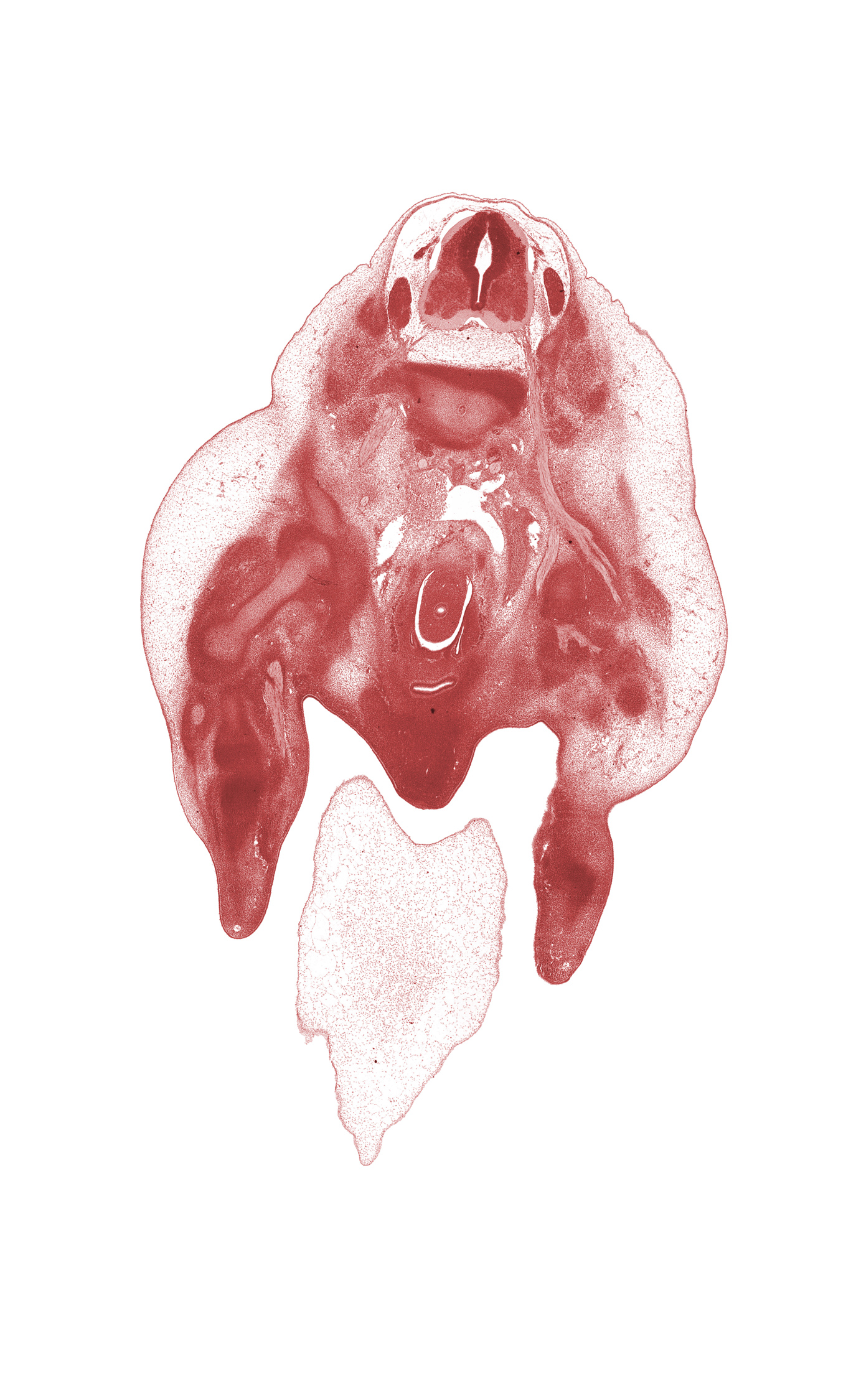 L-2 spinal ganglion, L-3 / L-4 intervertebral disc, L-3 spinal nerve, blastemata of lower back muscles, blastemata of medial thigh muscles, common iliac vein, femoral nerve, foot ray condensation, glans clitoris, hindgut, hindgut mesentery, internal iliac artery, labial swelling, lower part of urinary bladder, obturator nerve, postcardinal vein anastomosis