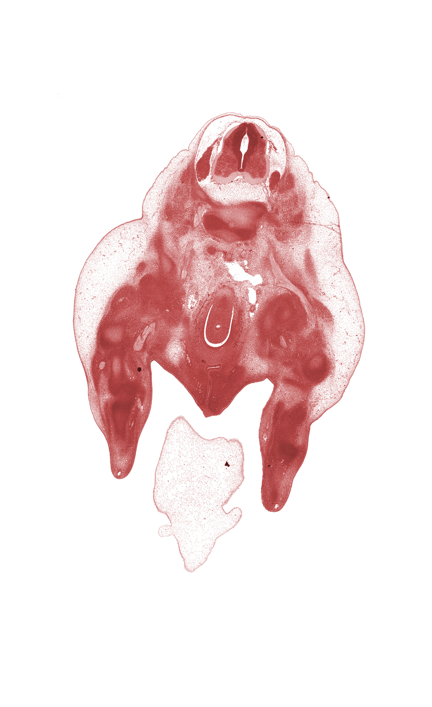 L-3 spinal ganglion, L-3 spinal nerve, blastemata of deep back muscles, common iliac vein, dorsal surface of foot, femoral nerve, hindgut, hindgut mesentery, leg region, marginal vein, median sacral nerve, peritoneal cavity, thigh, urethra, urethral fold, urethral groove