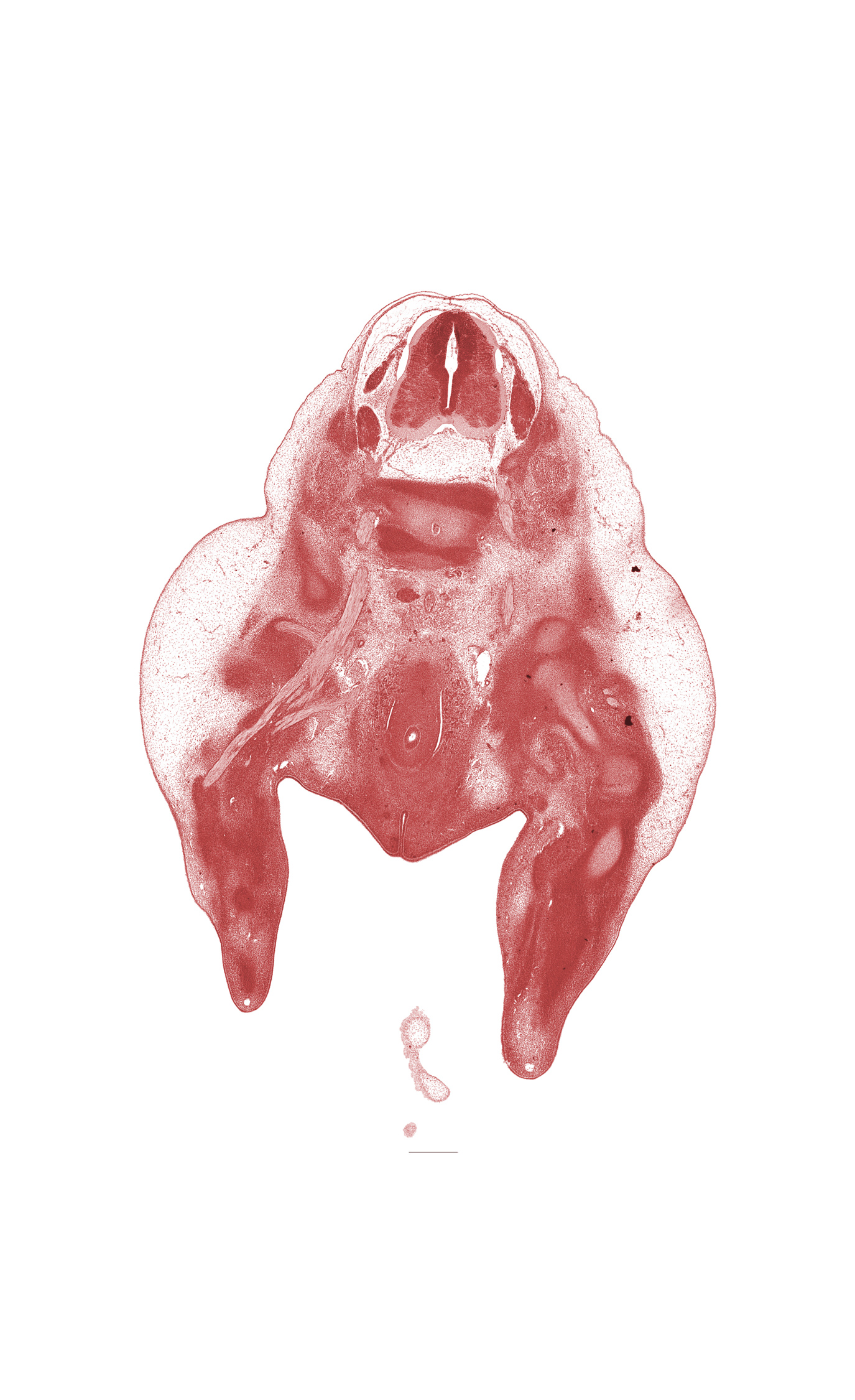 L-3 spinal ganglion, L-4 / L-5 intervertebral disc, L-4 spinal nerve, L-5 / S-1 intervertebral disc, caudal edge of peritoneal cavity, foot region, head of femur, hip joint, junction of hindgut and rectum, leg region, lumbosacral trunk, notochord, sacral plexus, sciatic nerve, subarachnoid space, thigh, tibia, urethral fold, urethral groove, urorectal septum