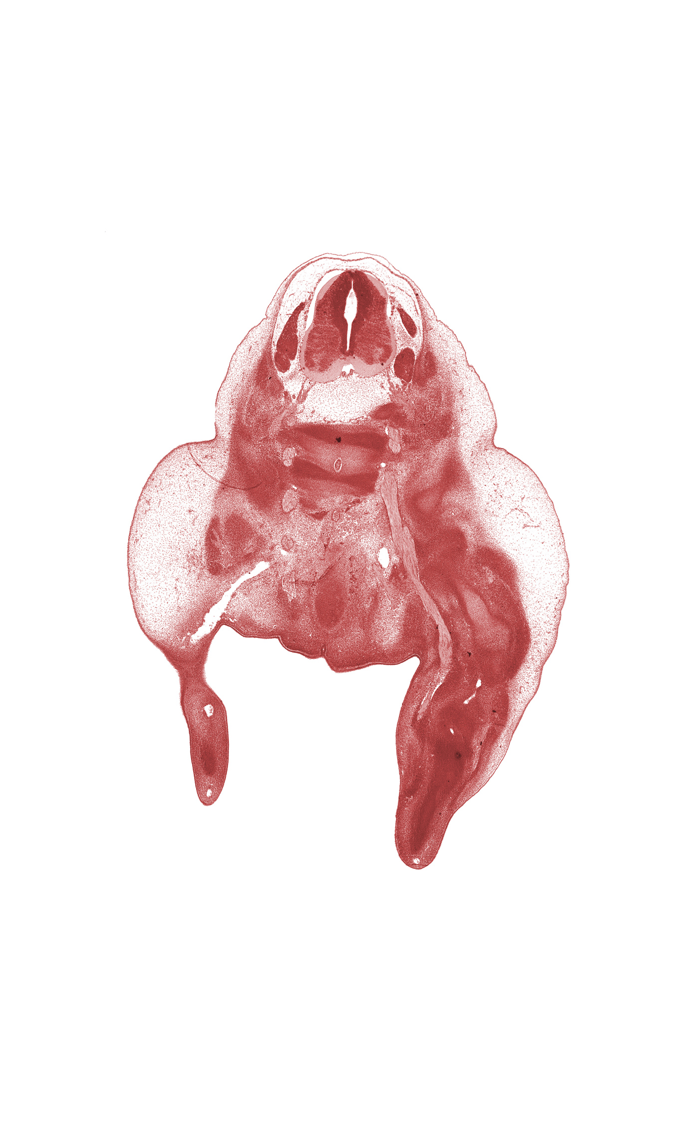 L-3 spinal ganglion, L-4 spinal ganglion, L-4 spinal nerve, L-5 / S-1 intervertebral disc, L-5 ventral primary ramus, S-1 / S-2 intervertebral region, S-1 ventral primary ramus, alar plate(s), basal plate, blastema of metatarsal, blastemata of posterior thigh muscles, central vein of thigh, floor plate, foot, labial swelling, marginal vein, notochord, rectum, roof plate, sciatic nerve, sulcus limitans, tibial nerve, urethral fold, urethral groove