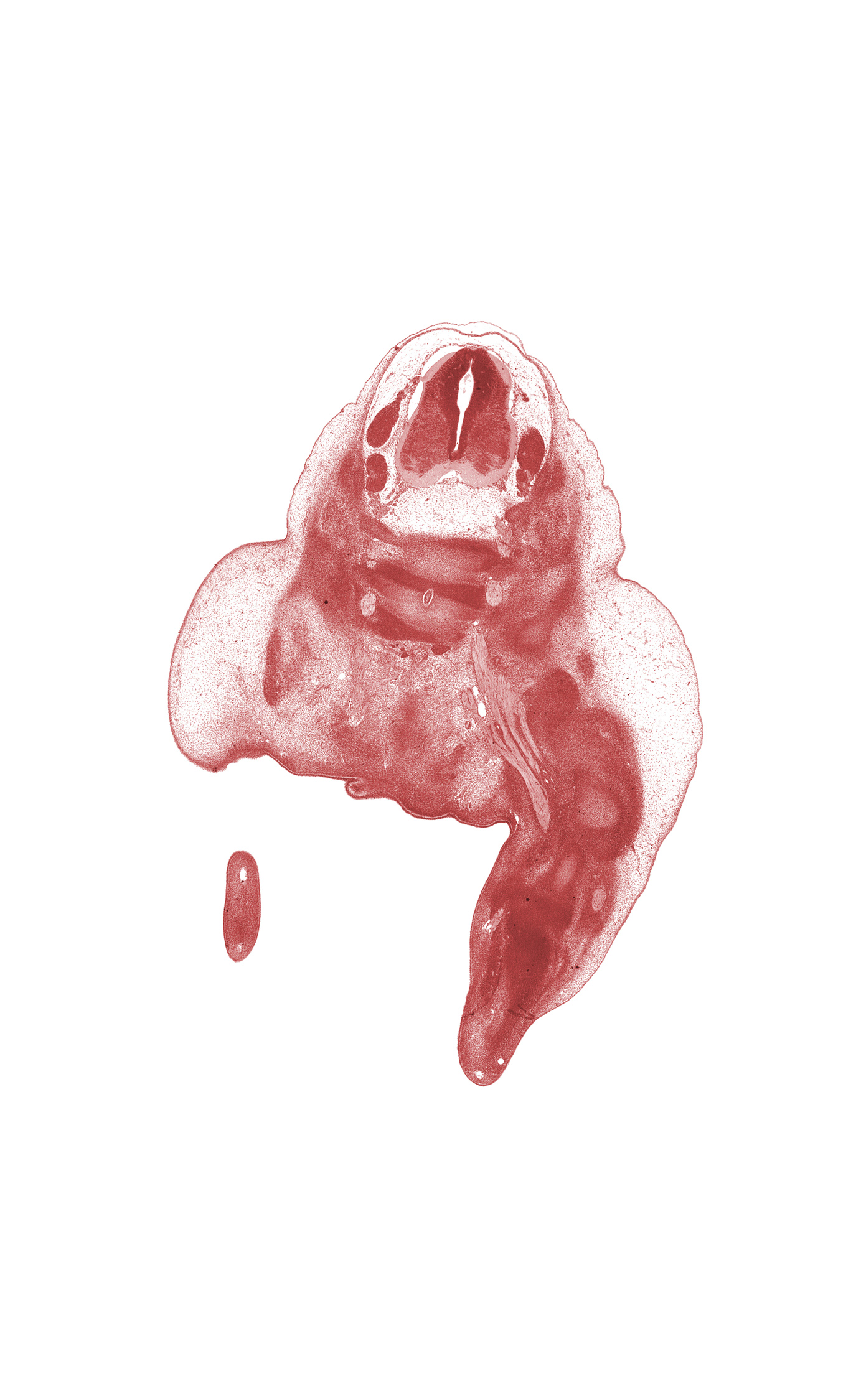 L-4 spinal ganglion, L-5 / S-1 intervertebral disc, L-5 ventral primary ramus, S-1 / S-2 intervertebral region, S-1 ventral primary ramus, S-2 / S-3 intervertebral region, S-2 ventral primary ramus, ala of sacrum, alar plate(s), anal pit, basal plate, blastemata of flexor muscles in leg, central canal, dorsal surface of foot, foot plate, marginal vein, notochord, sacral plexus, sulcus limitans