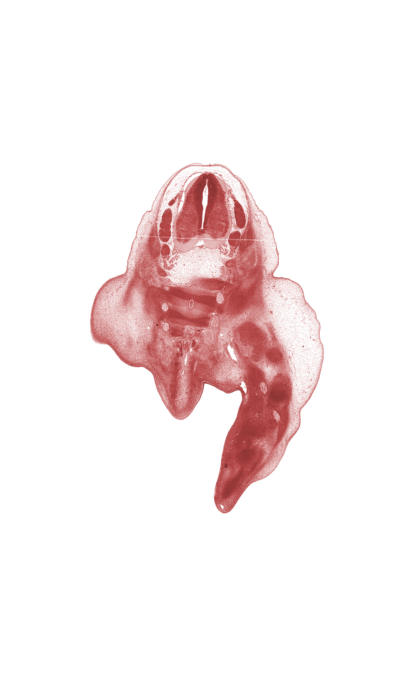 L-4 spinal ganglion, L-5 spinal ganglion, S-1 spinal nerve, S-2 / S-3 intervertebral region, S-2 ventral primary ramus, S-3 / S-4 intervertebral region, S-3 ventral primary ramus, ala of sacrum, caudal eminence, dorsal surface of foot, notochord, plantar surface of foot