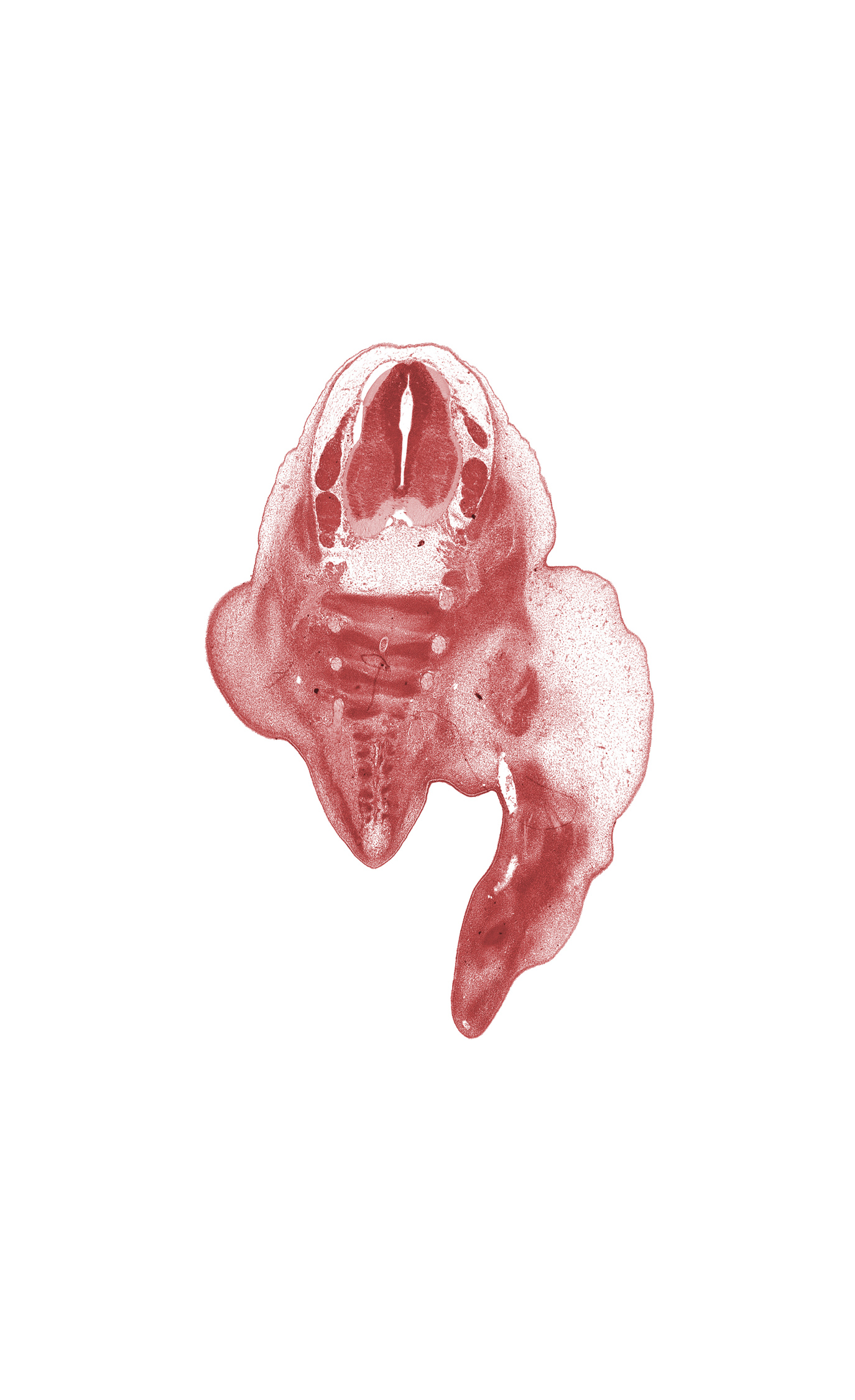 L-4 spinal ganglion, L-5 spinal ganglion, S-1 spinal nerve, S-2 / S-3 intervertebral region, S-2 ventral primary ramus, S-3 / S-4 intervertebral region, S-3 ventral primary ramus, S-4 / S-5 intervertebral region, S-4 ventral primary ramus, S-5 / Co-1 intervertebral region, central canal, foot region, leg region, subarachnoid space, thigh