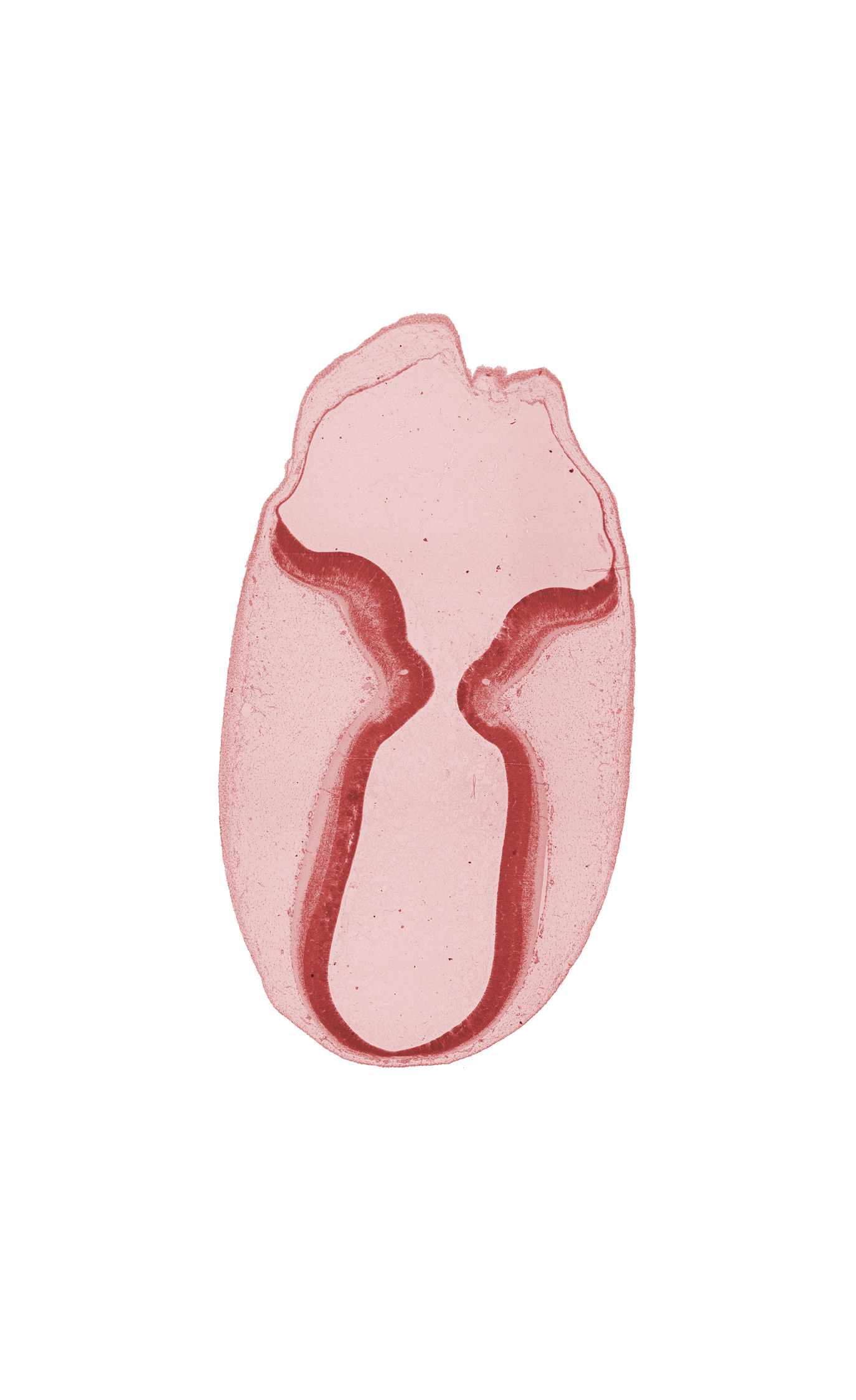 cerebral aqueduct (mesencoel), intermediate zone, isthmus of metencephalon, marginal zone, rhombencoel (fourth ventricle), trochlear nerve (CN IV), ventricular zone