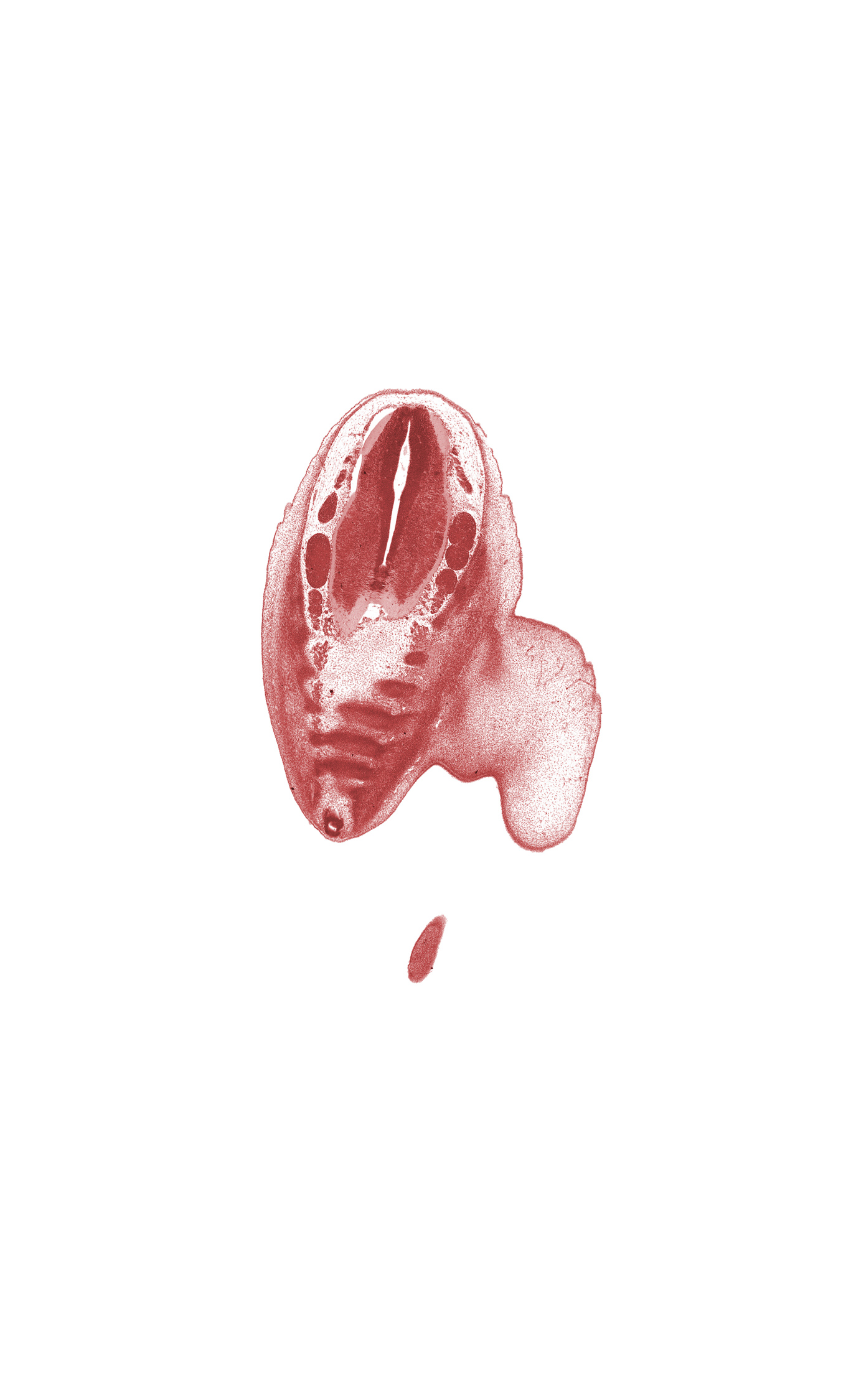 Co-1 ventral primary ramus, S-1 spinal ganglion, S-2 spinal ganglion, S-3 spinal nerve, S-4 spinal nerve, S-5 ventral primary ramus, caudal eminence, central canal, coccyx, edge of foot, filum terminale, osteogenic layer, subarachnoid space