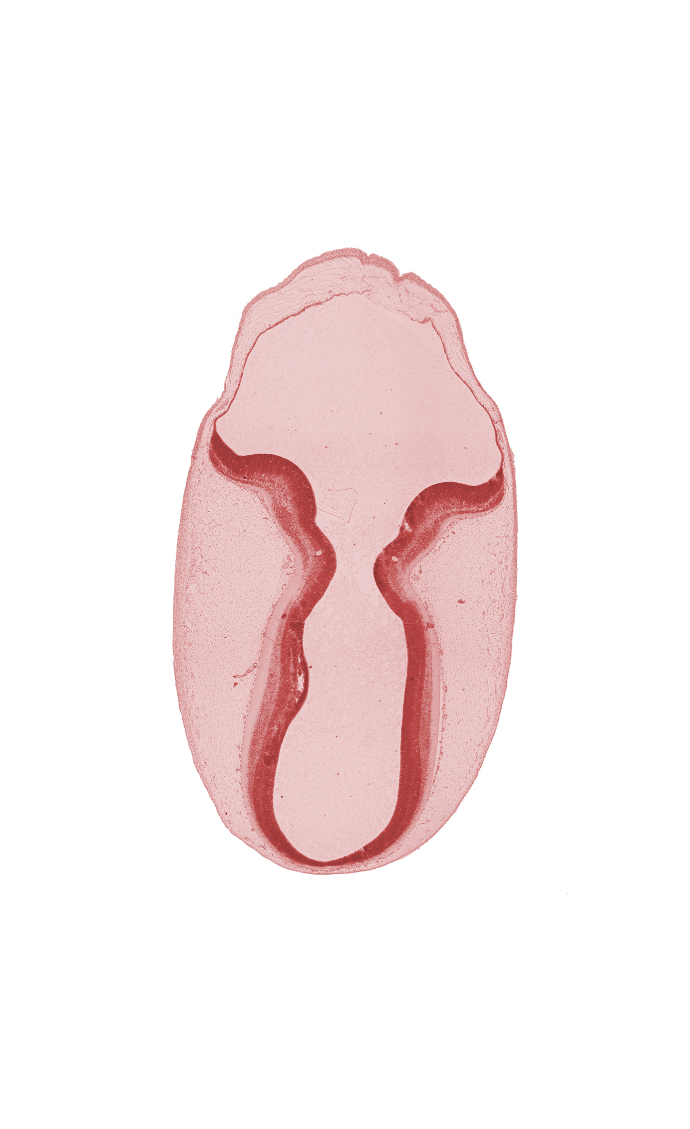 alar plate of metencephalon (cerebellum), intermediate zone, marginal zone, mesencephalon, metencephalon, subarachnoid space, surface ectoderm, trochlear nerve (CN IV), ventricular zone