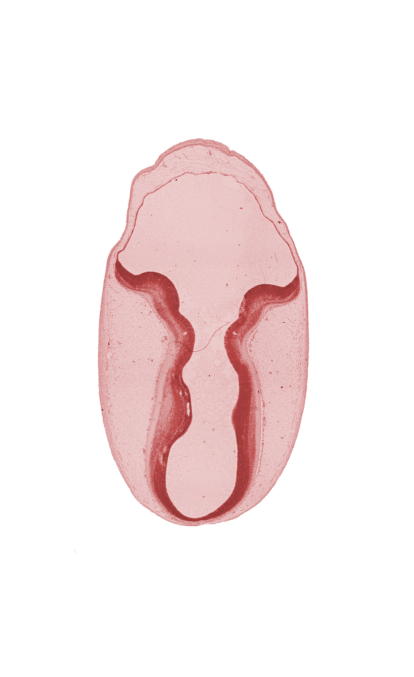 cephalic edge of osteogenic layer, cerebral aqueduct (mesencoel), external cerebellum, head mesenchyme, intermediate zone, internal cerebellum, marginal zone, rhombencoel (fourth ventricle), trochlear nerve (CN IV), ventricular zone