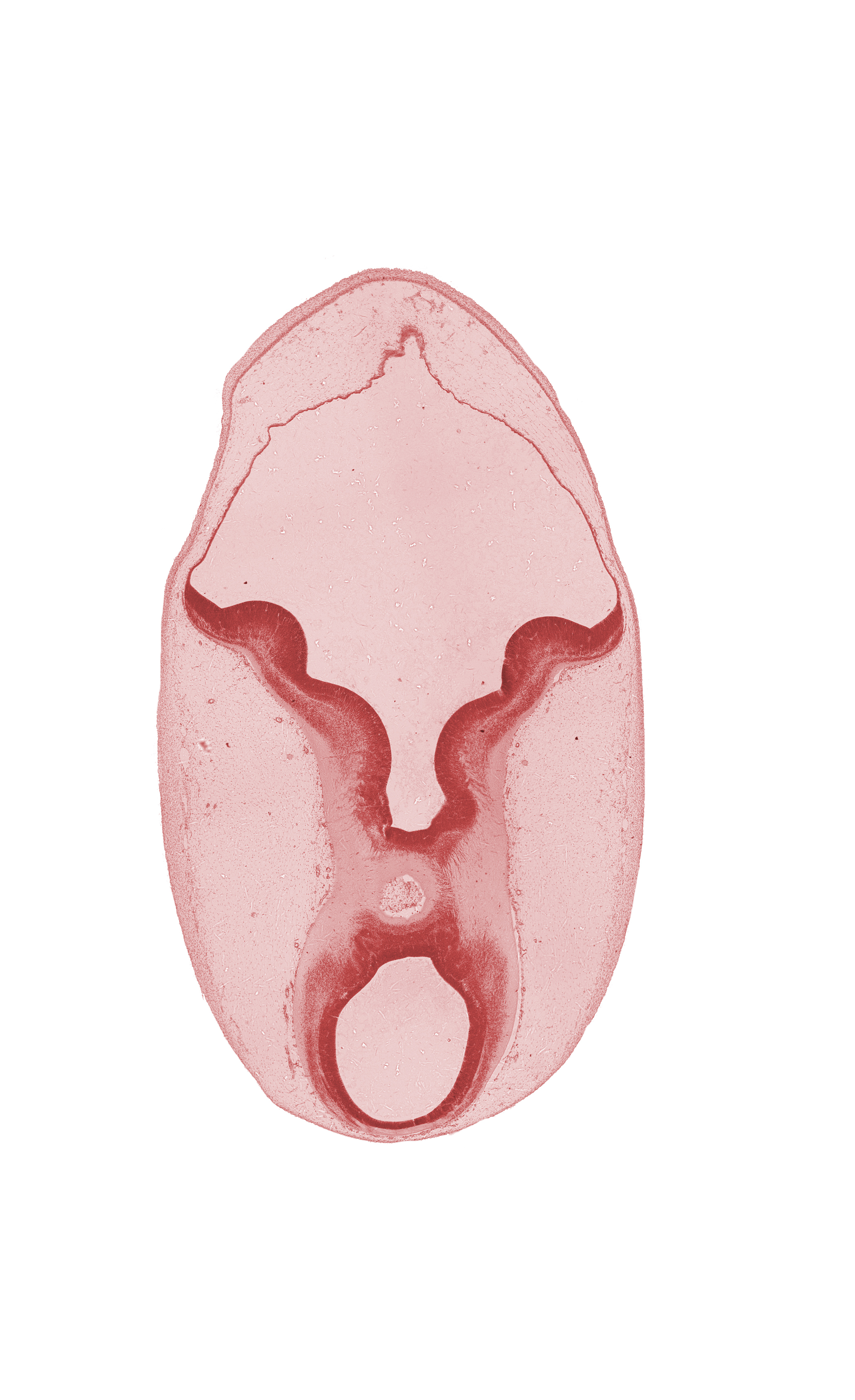 cerebral peduncle, commissure, edge of diverticulum of rhombencoel (fourth ventricle), intermediate zone, interpeduncular fossa, isthmic recess, junction of mesencephalon and metencephalon, marginal zone, osteogenic layer, rhombencoel (fourth ventricle), sulcus limitans, trochlear nerve (CN IV), ventricular zone