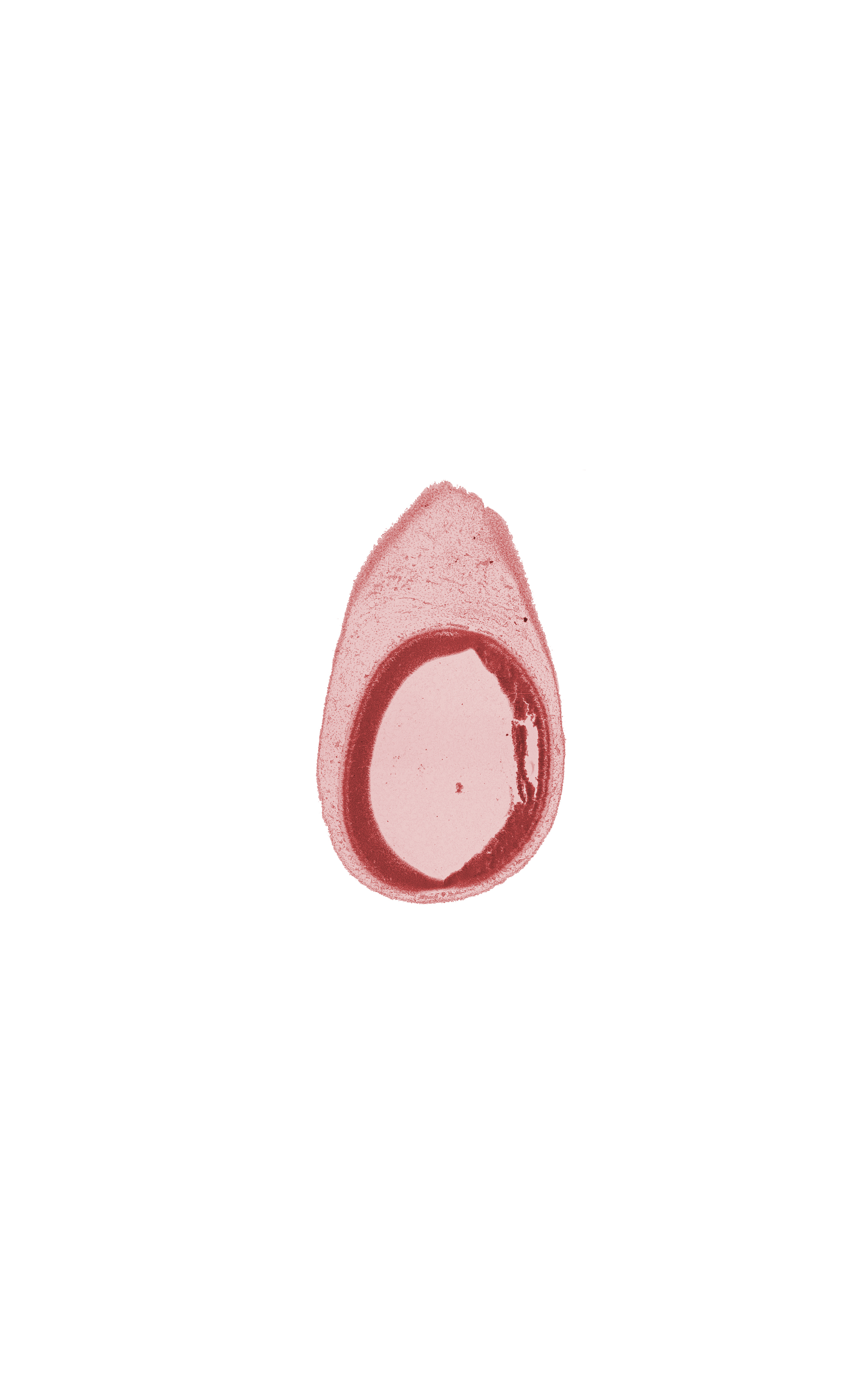 artifact separation(s), subarachnoid space, surface ectoderm, tectum of mesencephalon, vascular plexus