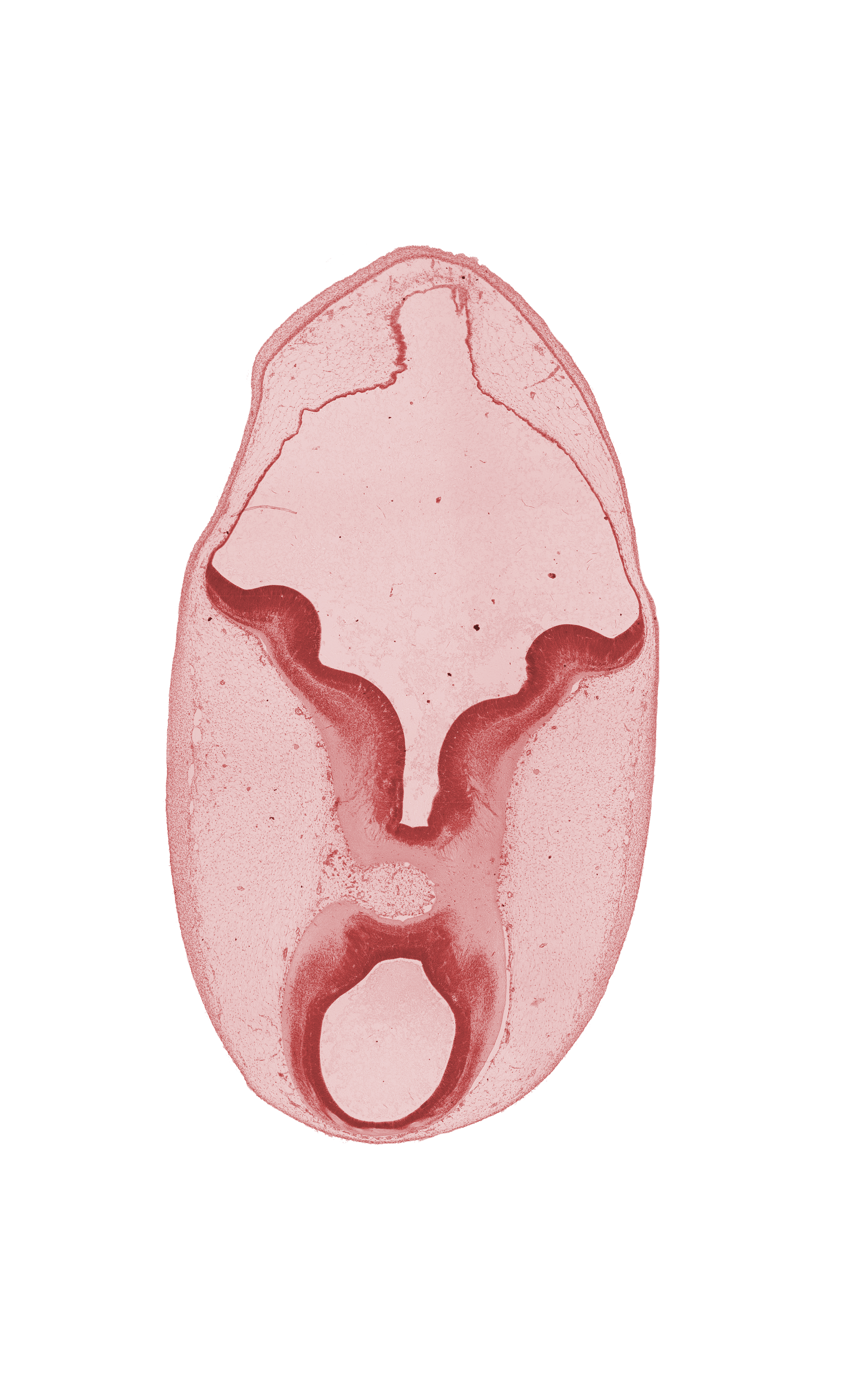 cerebral peduncle, diverticulum of rhombencoel (fourth ventricle), head mesenchyme, intermediate zone, interpeduncular fossa, marginal zone, mesencephalon, osteogenic layer, rhombencoel (fourth ventricle), subarachnoid space, surface ectoderm, vascular plexus, ventricular zone