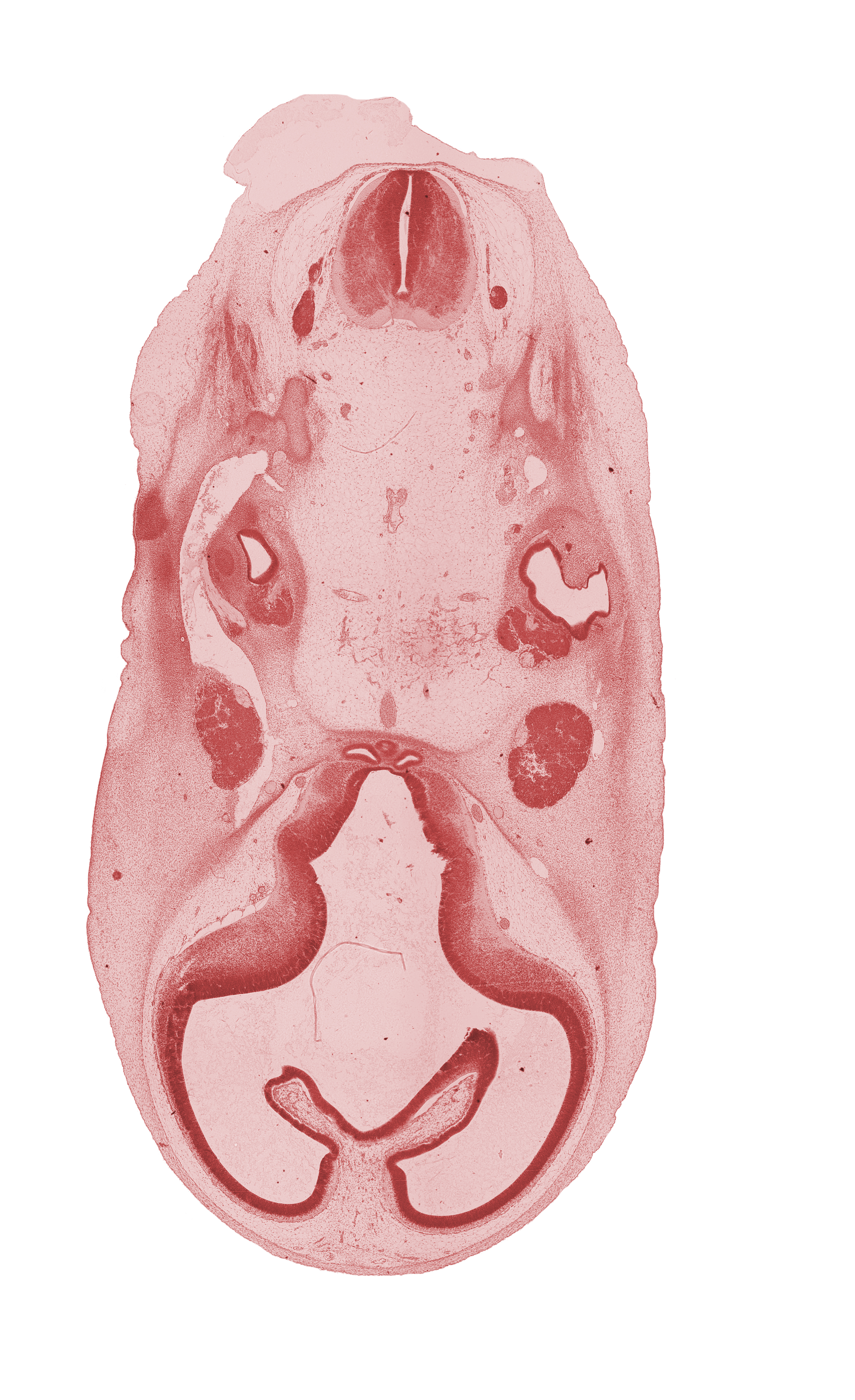 accessory nerve (CN XI), basilar artery, choroid fissure, corpus striatum, edge of pons region (metencephalon), hippocampal thickening, lateral semicircular duct, motor root of trigeminal nerve (CN V), neurohypophyseal bud, primary head vein, spinal accessory nerve (CN XI), subarachnoid space, torus hemisphericus, trigeminal ganglion (CN V), tuberal part of adenohypophysis, vagus nerve (CN X), vertebral artery, vestibular part of otic vesicle