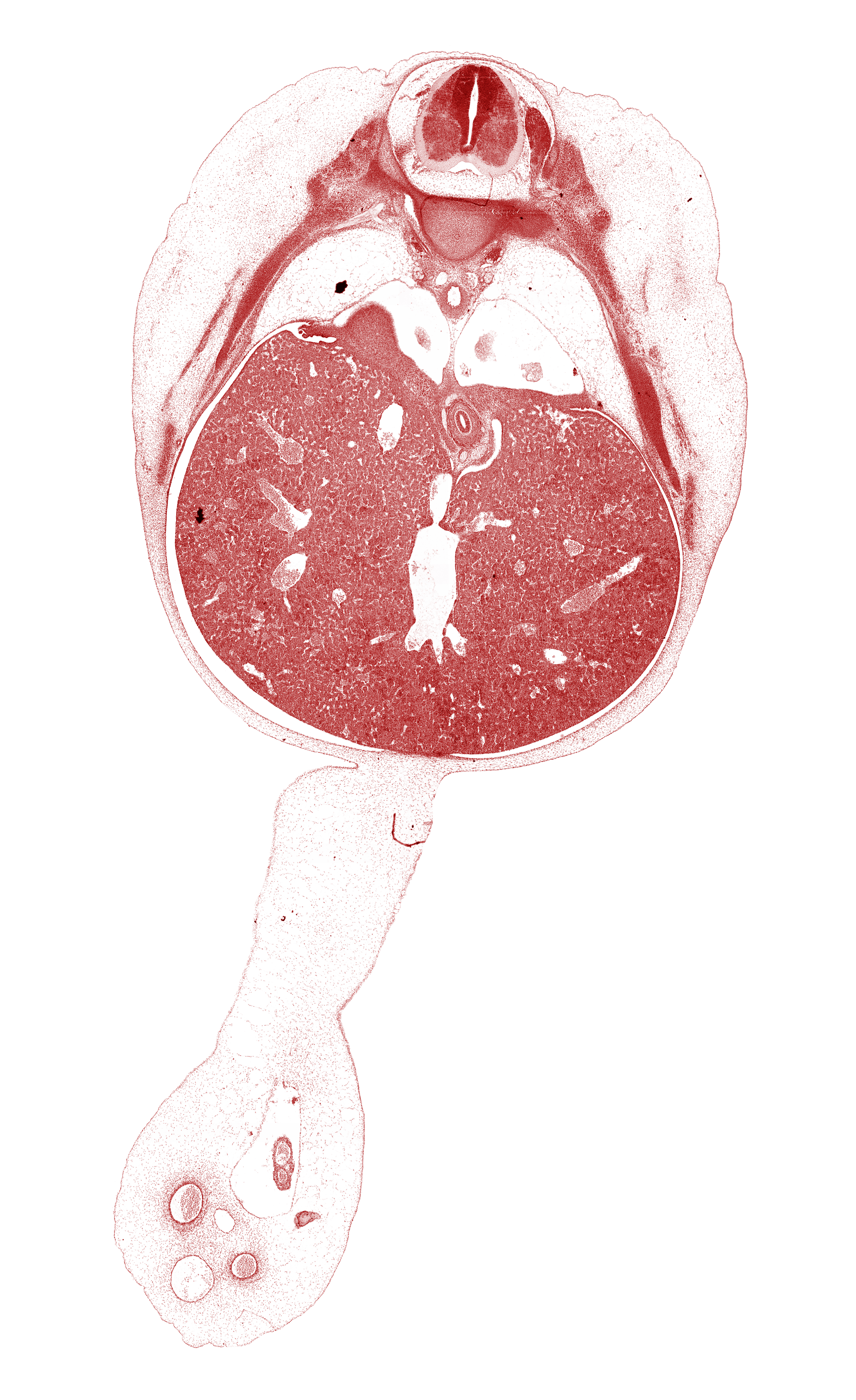 T-8 spinal ganglion, caudal edge of left lung, ductus venosus, esophagus, head of rib 9, inferior vena cava, lung, right, mucoid connective tissue in umbilical cord, omphalomesenteric artery, peritoneal cavity, postcardinal vein, rib 10, rib 9, suprarenal gland cortex, umbilical coelom