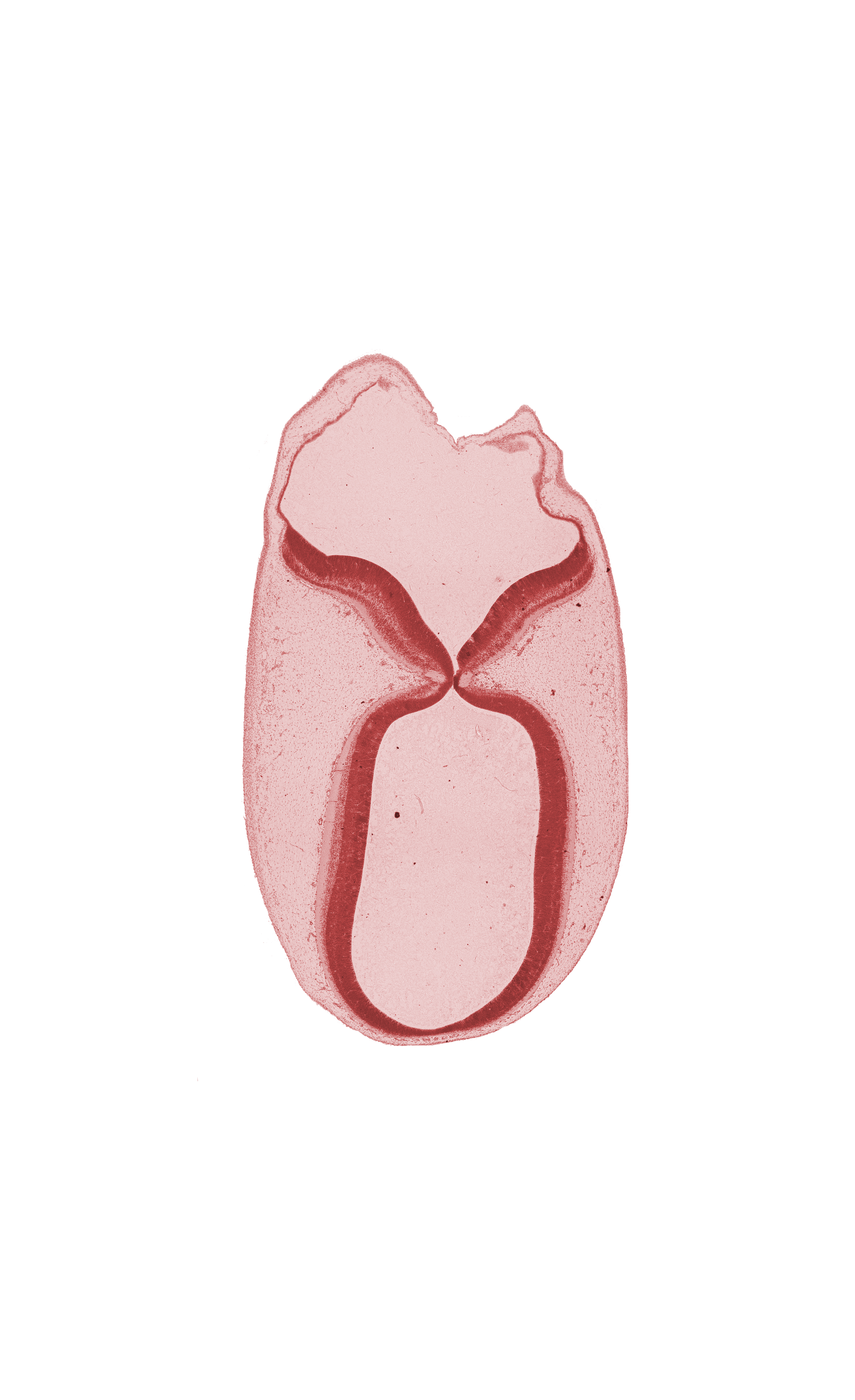 commissure, intermediate zone, junction of mesencephalon and metencephalon, marginal zone, roof plate, roof plate of mesencephalon (M2), root of trochlear nerve (CN IV), subarachnoid space, surface ectoderm, ventricular zone