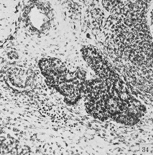 Transverse section of median thyroid