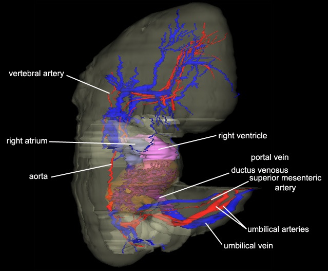 Movie 18-5 – Circulatory System