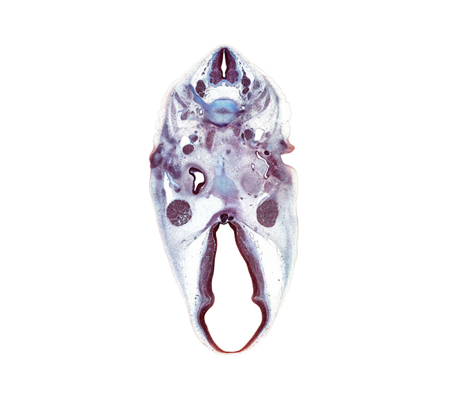 C-3 spinal ganglion, C-4 spinal ganglion, abducens nerve (CN VI), anterior cerebral artery, basi-occipital (basal plate), facial nerve (CN VII), hypoglossal nerve (CN XII), hypothalamus, inferior ganglion of vagus nerve (CN X), longus capitis muscle, marginal ridge, motor root of trigeminal nerve (CN V), neural arch, neurohypophysis, notochord, oculomotor nerve (CN III), osteogenic layer, otic capsule cartilage, pharyngeal arch 2 cartilage, precardinal vein (internal jugular vein), roof plate of diencephalon, trochlear nerve (CN IV), tuberal part of adenohypophysis, tympanic cavity, ventral thalamus, vertebral artery