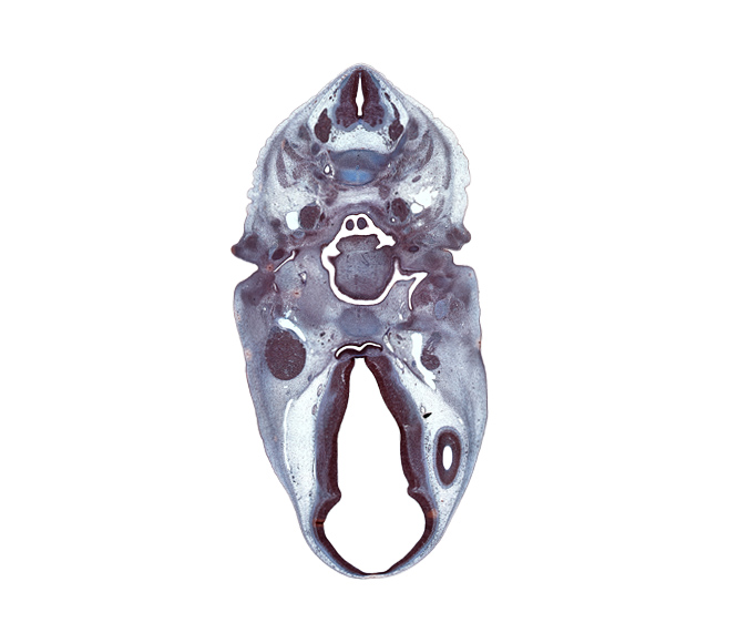 C-3 / C-4 intervertebral disc, C-4 spinal ganglion, abducens nerve (CN VI), adenohypophysis, anterior cerebral artery, body of sphenoid, cephalic edge of arytenoid swelling, cervical plexus, chorda tympani nerve, dorsal thalamus, epiglottis, glossopharyngeal nerve (CN IX), hypothalamus, inferior ganglion of vagus nerve (CN X), junction of internal carotid and posterior communicating arteries, lateral ventricle, mandibular nerve (CN V₃), middle pharyngeal constrictor muscle, nasopharynx, oculomotor nerve (CN III), pharyngeal arch 2 cartilage, pharyngotympanic tube, retropharyngeal space, superior cervical sympathetic ganglion, tongue root, trochlear nerve (CN IV), tympanic cavity, ventral thalamus, vertebral artery