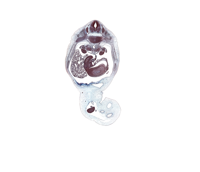 T-11 / T-12 intervertebral disc, T-11 spinal ganglion, allantois, aorta, caudal edge of left lobe of liver, duodenum (second part), gonad, head of pancreas, hepatic portal vein, inferior vena cava, kidney (metanephros), latissimus dorsi muscle, left subcardinal vein, left umbilical artery, lesser sac, mesonephric duct, mesonephros, midpoint of midgut, neural arch, omphalomesenteric vessels, right lobe of liver, right umbilical artery, splenic vein, subarachnoid space, superior mesenteric artery, umbilical coelom, umbilical vein, wall of stomach