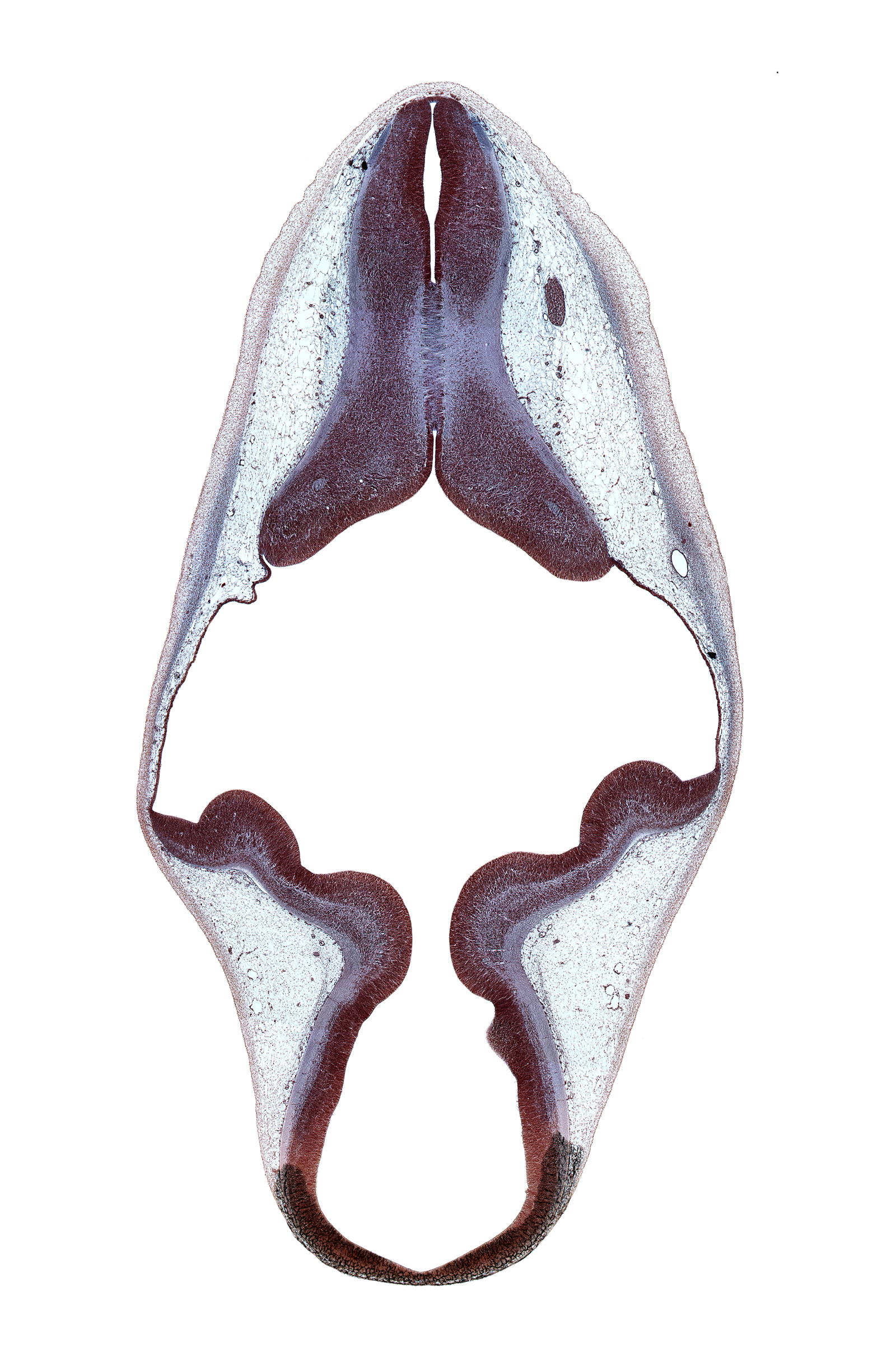 accessory nerve (CN XI), alar plate of metencephalon (cerebellum), alar plate(s), basal plate, basal plate of mesencephalon, basal plate of metencephalon, cerebral aqueduct (mesocoele), decussation in floor plate, fiber tract, isthmus of rhombencephalon, rhombencoel (fourth ventricle), roof of rhombencoel (fourth ventricle), roof plate, roof plate of mesencephalon, root of vagus nerve (CN X), sulcus limitans, trochlear nerve (CN IV)