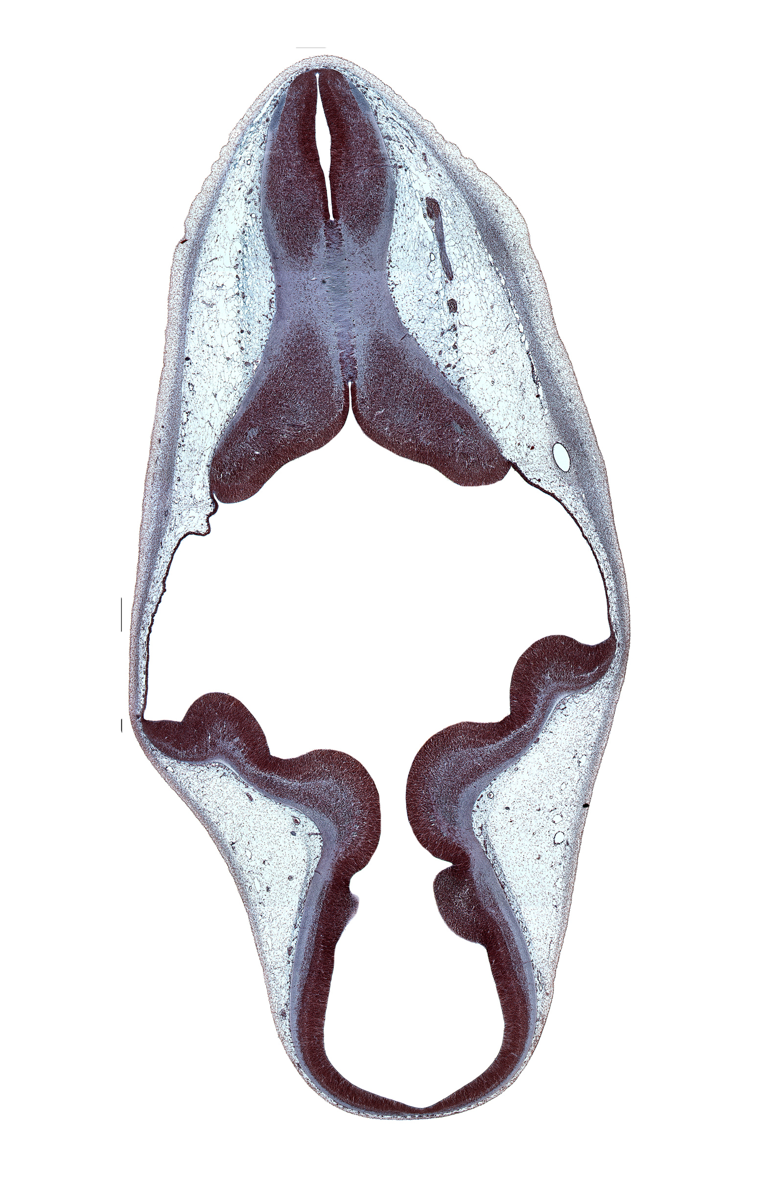 accessory nerve (CN XI), alar plate(s), decussation, endolymphatic sac, intermediate zone, marginal zone, myelencephalon, osteogenic layer, roof of rhombencoel (fourth ventricle), root of vagus nerve (CN X), subarachnoid space, sulcus limitans, trochlear nerve (CN IV), ventricular zone