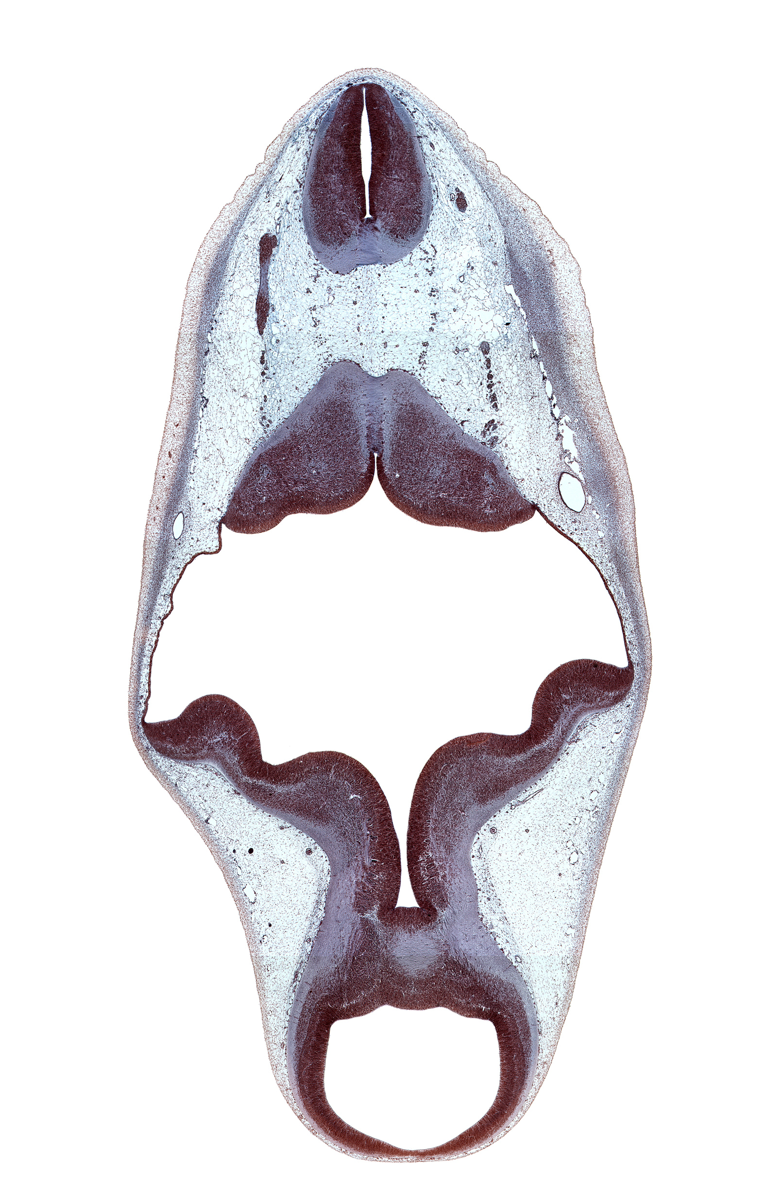 accessory nerve (CN XI), alar plate of metencephalon (cerebellum), alar plate(s), basal plate, cerebral aqueduct (mesocoele), cerebral peduncle, head mesenchyme, myelencephalon, osteogenic layer, posterior dural venous plexus, region of cervical flexure, rhombencoel (fourth ventricle), roof of rhombencoel (fourth ventricle), root of hypoglossal nerve (CN XII), sulcus limitans, tectum, tegmentum, trochlear nerve (CN IV)