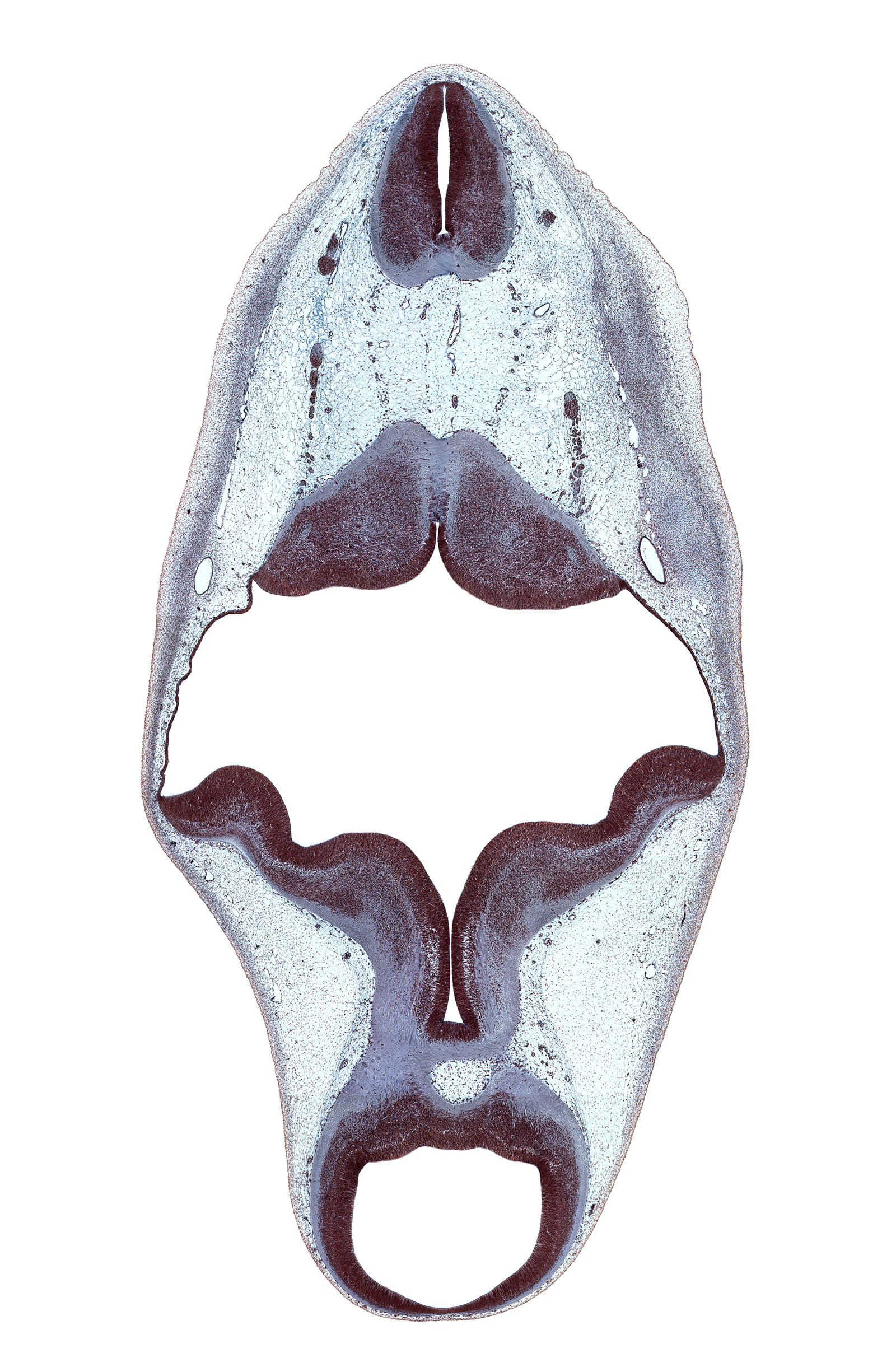 accessory nerve (CN XI), alar plate(s), basal plate, cerebral aqueduct (mesocoele), cerebral peduncle, endolymphatic sac, floor plate of mesencephalon, floor plate of metencephalon, intermediate zone, interpeduncular fossa, junction of brain and spinal cord, marginal zone, myelencephalon, osteogenic layer, otic capsule cartilage, region of cervical flexure, rhombencoel (fourth ventricle), roof plate of mesencephalon, root of vagus nerve (CN X), spinal accessory nerve (CN XI), sulcus limitans, trochlear nerve (CN IV), ventricular zone, vertebral artery