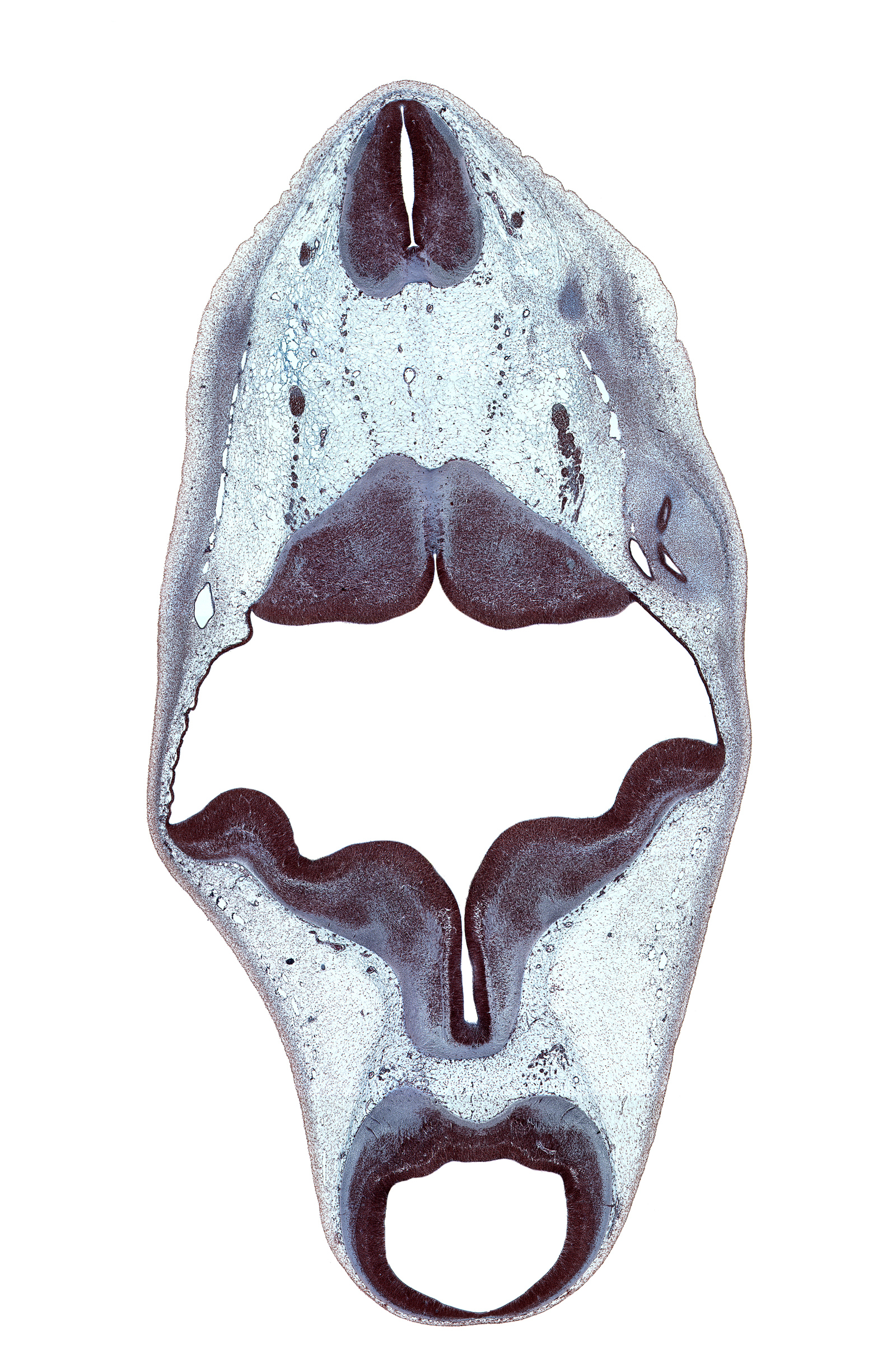 C-1 ventral root, accessory nerve (CN XI), alar plate of metencephalon (cerebellum), alar plate(s), anterior semicircular duct, basal plate, cephalic edge of C-1 spinal ganglion, cerebral aqueduct (mesocoele), cerebral peduncle, endolymphatic sac, floor plate, interpeduncular fossa, mesencephalon, metencephalon, osteogenic layer, otic capsule cartilage, posterior dural venous plexus, posterior semicircular duct, rhombencoel (fourth ventricle), roof plate, root of oculomotor nerve (CN III), root of vagus nerve (CN X), spinal accessory nerve (CN XI), subarachnoid space, sulcus limitans, vertebral artery