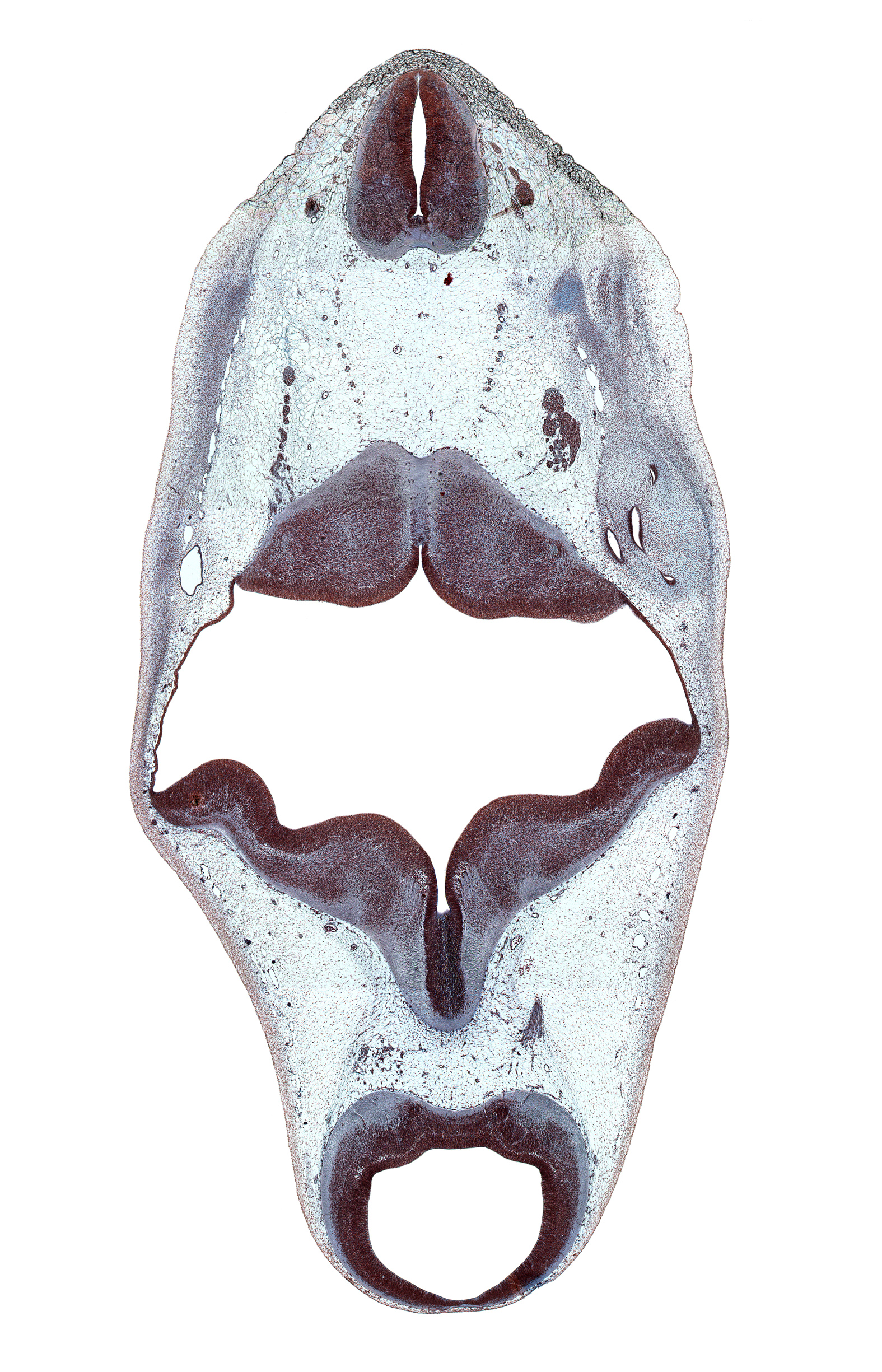 C-1 spinal ganglion, C-1 ventral root, alar plate(s), anterior semicircular duct, basal plate, central canal, cephalic edge of exoccipital, cerebral aqueduct (mesocoele), common crus, floor plate, median sulcus, mesencephalon, metencephalon, myelencephalon, otic capsule cartilage, posterior semicircular duct, region of mesencephalic (cephalic) flexure, rhombencoel (fourth ventricle), roof of rhombencoel (fourth ventricle), roof plate, root of hypoglossal nerve (CN XII), root of oculomotor nerve (CN III), spinal accessory nerve (CN XI), spinal cord, subarachnoid space, sulcus limitans, trochlear nerve (CN IV)