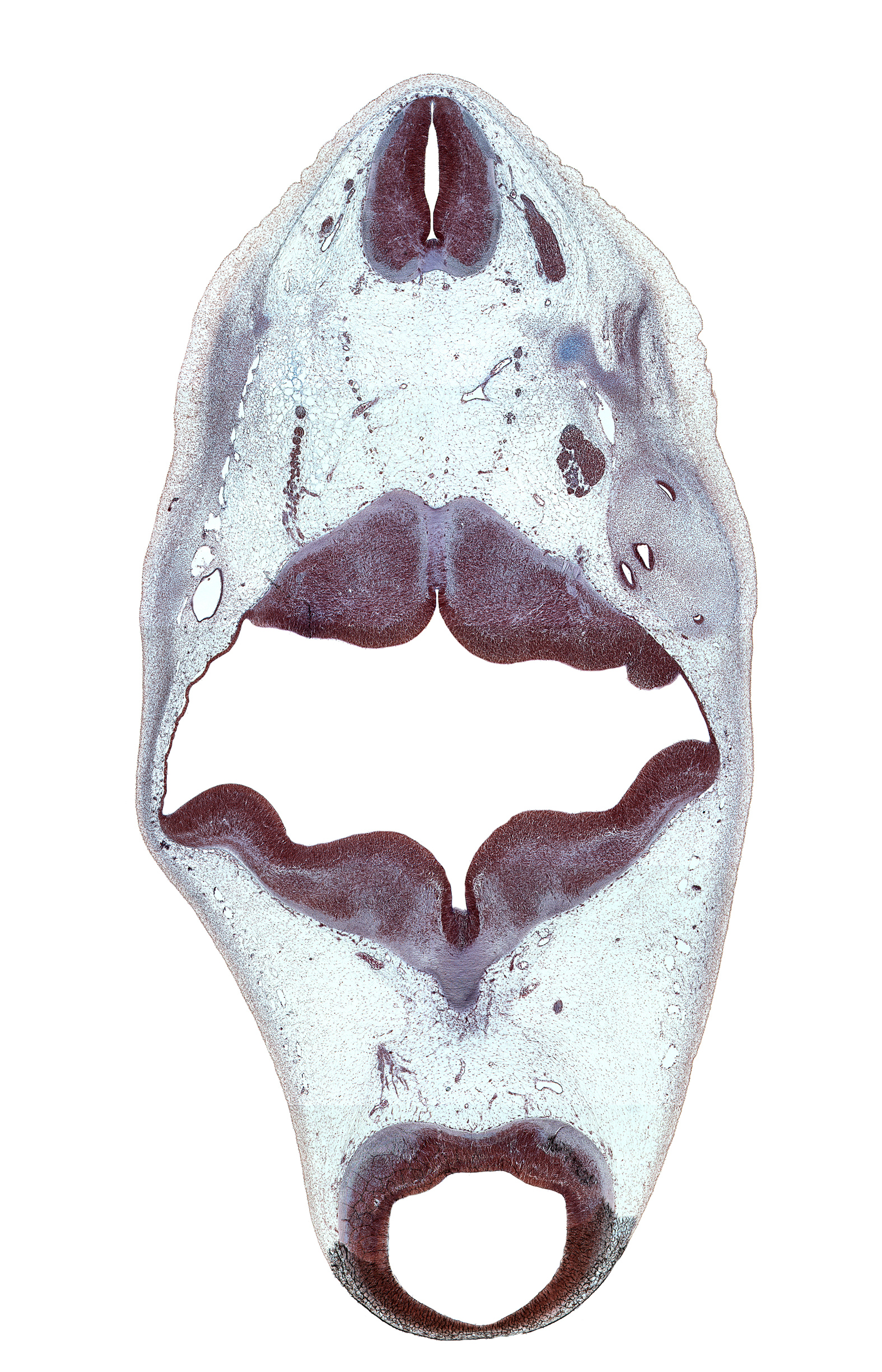 C-1 spinal ganglion, C-1 ventral root, alar plate(s), anterior semicircular duct, basal plate, cerebral aqueduct (mesocoele), common crus, decussation in floor plate of myelencephalon, floor plate, mesencephalon, oculomotor nerve (CN III), posterior dural venous plexus, posterior semicircular duct, roof of rhombencoel (fourth ventricle), roof plate, root of oculomotor nerve (CN III), sulcus limitans, superior ganglion of vagus nerve (CN X), tectum, tegmentum, trochlear nerve (CN IV), vertebral artery