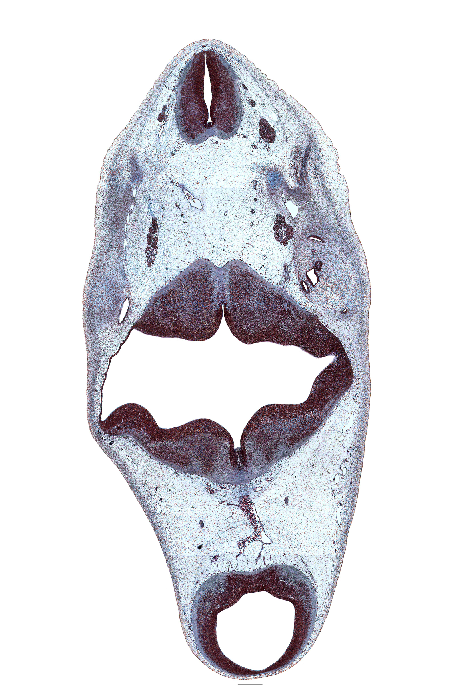 C-1 spinal ganglion, alar plate(s), anterior semicircular duct, central canal, cerebral aqueduct (mesocoele), decussation, median sulcus, middle dural venous plexus, otic capsule cartilage, posterior dural venous plexus, posterior semicircular duct, rhombencoel (fourth ventricle), right posterior cerebral artery, root of glossopharyngeal nerve (CN IX), spinal accessory nerve (CN XI), subarachnoid space, superior ganglion of vagus nerve (CN X), termination of basilar artery, vertebral artery