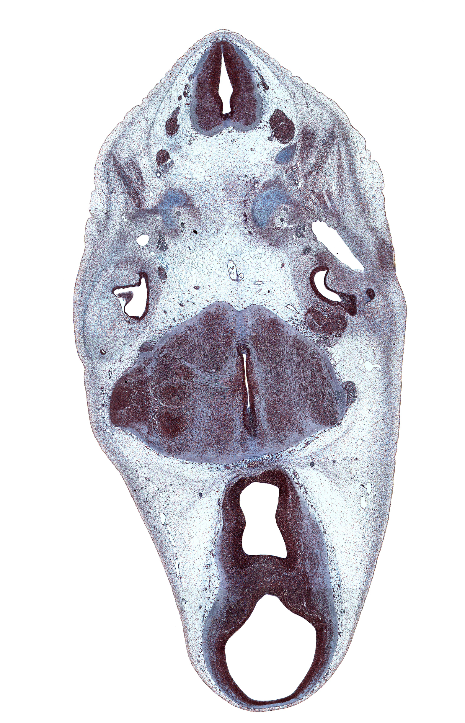 C-1 spinal nerve, C-2 spinal ganglion, anterior dural venous plexus, basilar artery, central canal, cephalic edge of auricle, cerebral aqueduct (mesocoele), decussation, dura mater, edge of foramen magnum, fiber tract, hypoglossal nerve (CN XII), junction of precardinal and primary head veins, median sulcus in floor of rhombencoel (fourth ventricle), neural arch of C-1 vertebra (atlas), oculomotor nerve (CN III), osteogenic layer, root of facial nerve (CN VII), saccule(s), spinal accessory nerve (CN XI), spinal tract of trigeminal nerve (CN V), subarachnoid space, third ventricle, trochlear nerve (CN IV), vascular plexus, vertebral artery, vestibulocochlear ganglion (CN VIII)