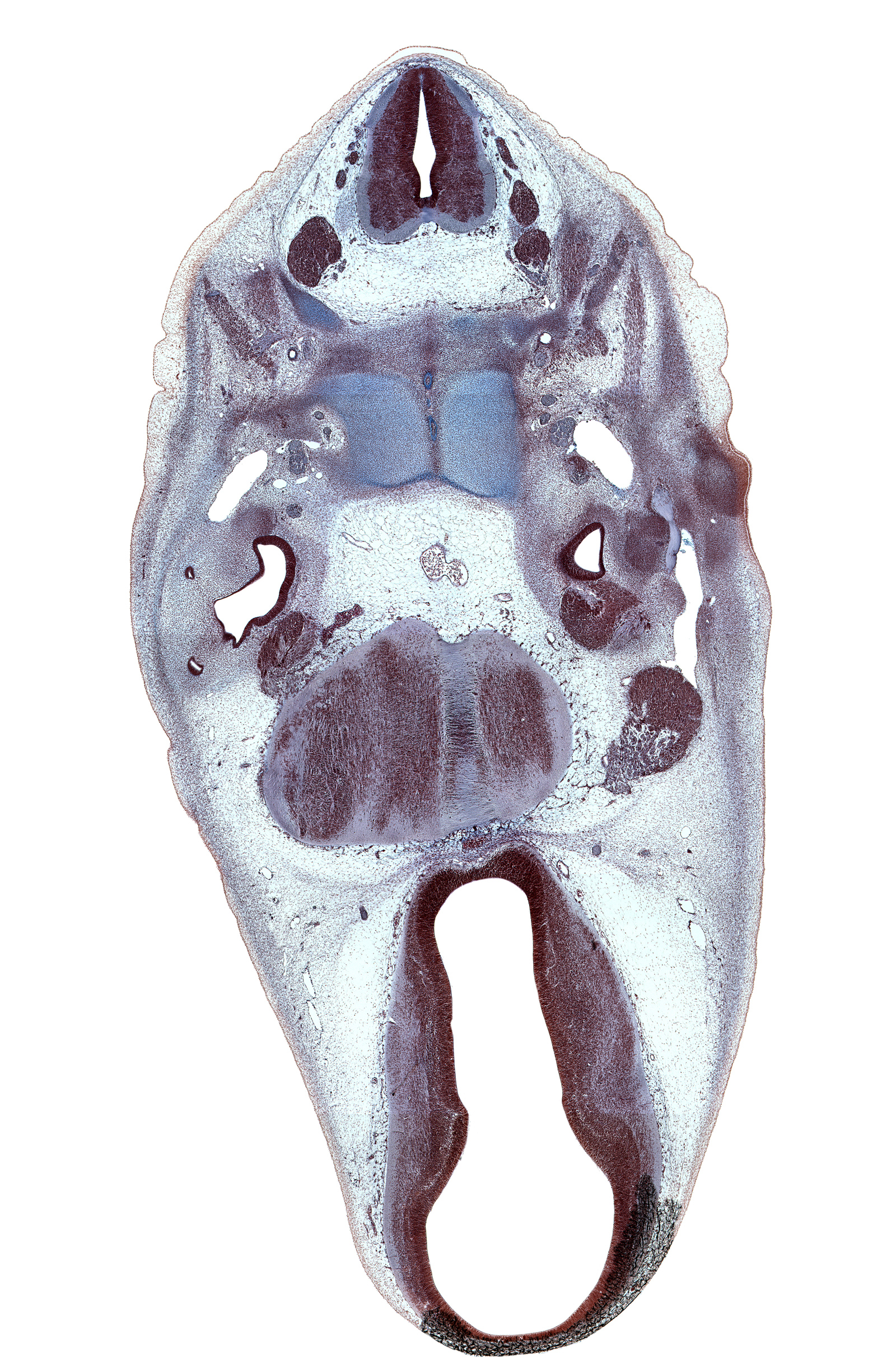 C-1 spinal nerve, C-1 vertebra (atlas), C-2 spinal ganglion, C-2 spinal nerve, C-3 spinal ganglion, atlanto-occipital joint, auricle, basi-occipital (basal plate), basilar artery, decussation in floor plate of metencephalon, dorsal thalamus, dural band for tentorium cerebelli, facial nerve (CN VII), horizontal part of facial nerve (CN VII), hypoglossal canal, hypoglossal nerve (CN XII), hypothalamus, marginal ridge, neural arch of C-1 vertebra (atlas), notochord, pons region (metencephalon), posterior communicating artery, precardinal vein (internal jugular vein), primary head vein, root of abducens nerve (CN VI), saccule(s), subarachnoid space, trigeminal ganglion (CN V), ventral thalamus