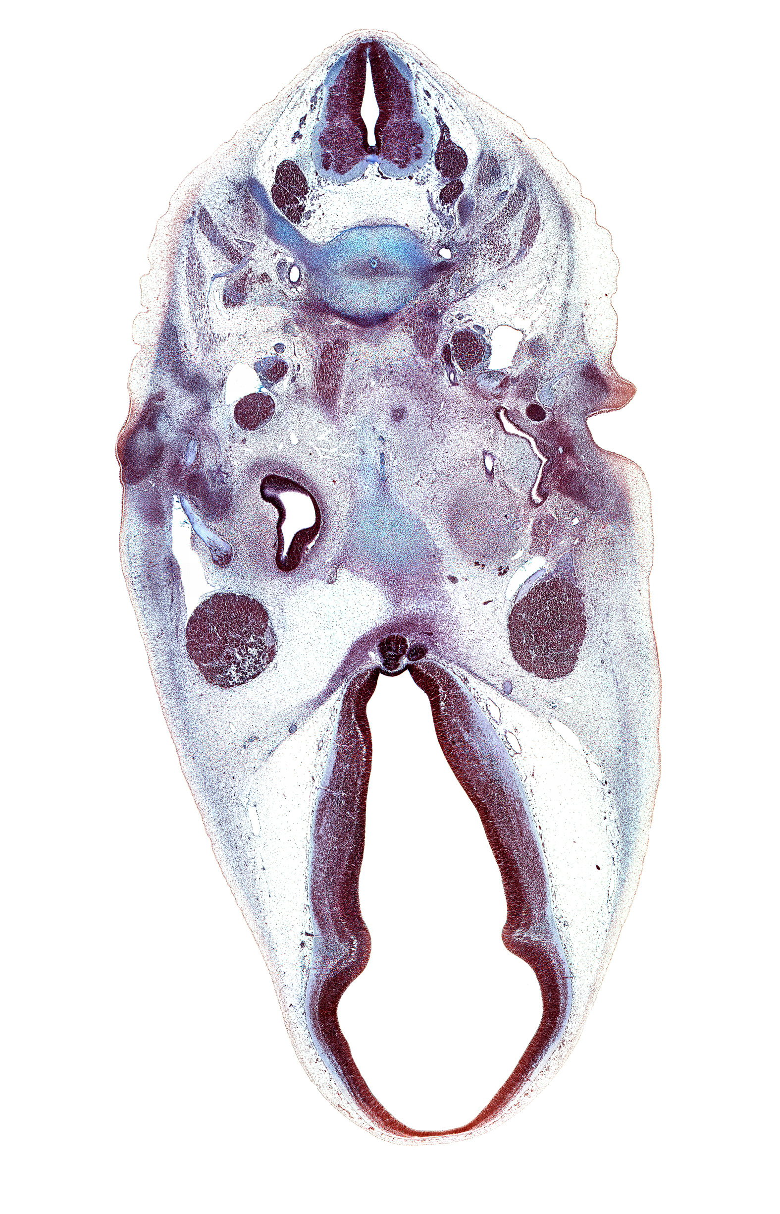 C-3 spinal ganglion, C-4 spinal ganglion, abducens nerve (CN VI), anterior cerebral artery, basi-occipital (basal plate), facial nerve (CN VII), hypoglossal nerve (CN XII), hypothalamus, inferior ganglion of vagus nerve (CN X), longus capitis muscle, marginal ridge, motor root of trigeminal nerve (CN V), neural arch, neurohypophysis, notochord, oculomotor nerve (CN III), osteogenic layer, otic capsule cartilage, pharyngeal arch 2 cartilage, precardinal vein (internal jugular vein), roof plate of diencephalon, trochlear nerve (CN IV), tuberal part of adenohypophysis, tympanic cavity, ventral thalamus, vertebral artery