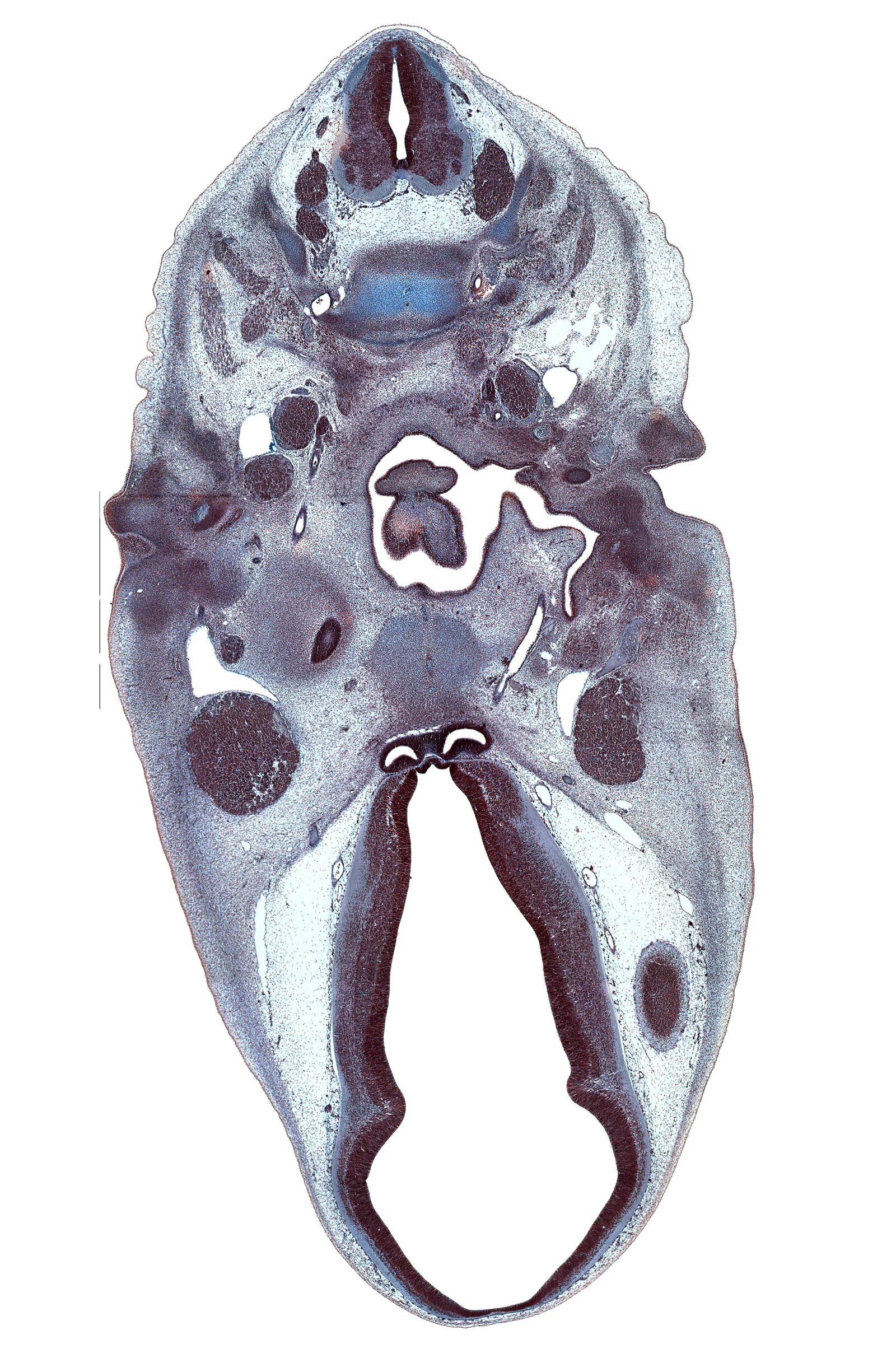 C-2 / C-3 intervertebral disc, C-3 / C-4 intervertebral disc, C-4 spinal ganglion, C-4 spinal nerve, abducens nerve (CN VI), anterior cerebral artery, caudal edge of cochlear duct, centrum of C-3 vertebra, dorsal thalamus, edge of cerebral vesicle(s), edge of epiglottis, edge of tongue root, glossopharyngeal nerve (CN IX), hypothalamic sulcus, hypothalamus, internal carotid artery, mandibular nerve (CN V₃), marginal ridge, neurohypophysis, pharyngeal arch 2 cartilage, pharyngotympanic tube, posterior communicating artery, primary head vein, retropharyngeal space, spinal accessory nerve (CN XI), subarachnoid space, trigeminal ganglion (CN V), tuberal part of adenohypophysis, ventral thalamus