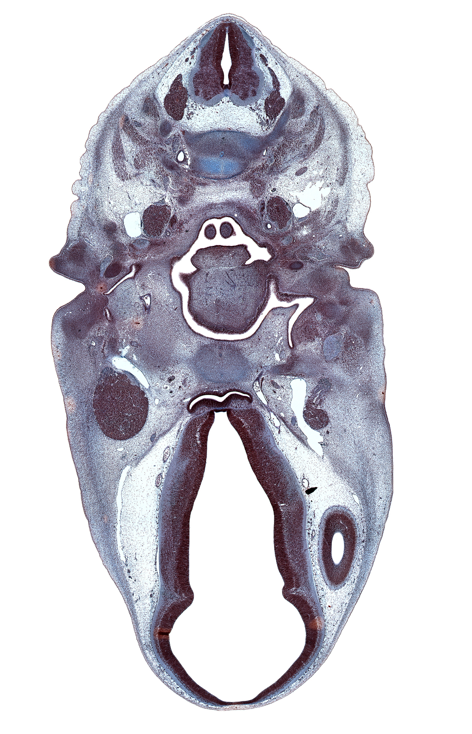 C-3 / C-4 intervertebral disc, C-4 spinal ganglion, abducens nerve (CN VI), adenohypophysis, anterior cerebral artery, body of sphenoid, cephalic edge of arytenoid swelling, cervical plexus, chorda tympani nerve, dorsal thalamus, epiglottis, glossopharyngeal nerve (CN IX), hypothalamus, inferior ganglion of vagus nerve (CN X), junction of internal carotid and posterior communicating arteries, lateral ventricle, mandibular nerve (CN V₃), middle pharyngeal constrictor muscle, nasopharynx, oculomotor nerve (CN III), pharyngeal arch 2 cartilage, pharyngotympanic tube, retropharyngeal space, superior cervical sympathetic ganglion, tongue root, trochlear nerve (CN IV), tympanic cavity, ventral thalamus, vertebral artery