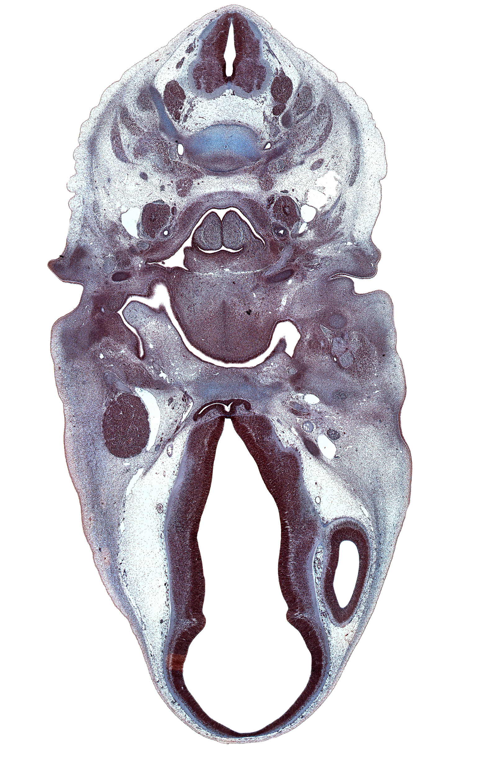 C-3 / C-4 intervertebral disc, C-4 spinal ganglion, C-4 spinal nerve, C-4 ventral root, C-5 dorsal root, C-5 spinal ganglion, C-5 spinal nerve, adenohypophysis, anterior cerebral artery, arytenoid swelling, auricle, cerebral vesicle (telencephalon), epiglottis, fusion region between cerebral vesicle and diencephalon, hypoglossal sulcus, hypothalamus, internal carotid artery, mandibular nerve (CN V₃), maxillary nerve (CN V₂), middle cerebral artery, neural arch of C-4 vertebra, oculomotor nerve (CN III), ophthalmic nerve (CN V₁), osteogenic layer, otic ganglion, pharyngeal arch 1 cartilage (Meckel), posterior digastric / stylohyoid muscles blastemata, roof plate of diencephalon, spinal accessory nerve (CN XI), termination of internal carotid artery, tongue root, trochlear nerve (CN IV), ventral thalamus