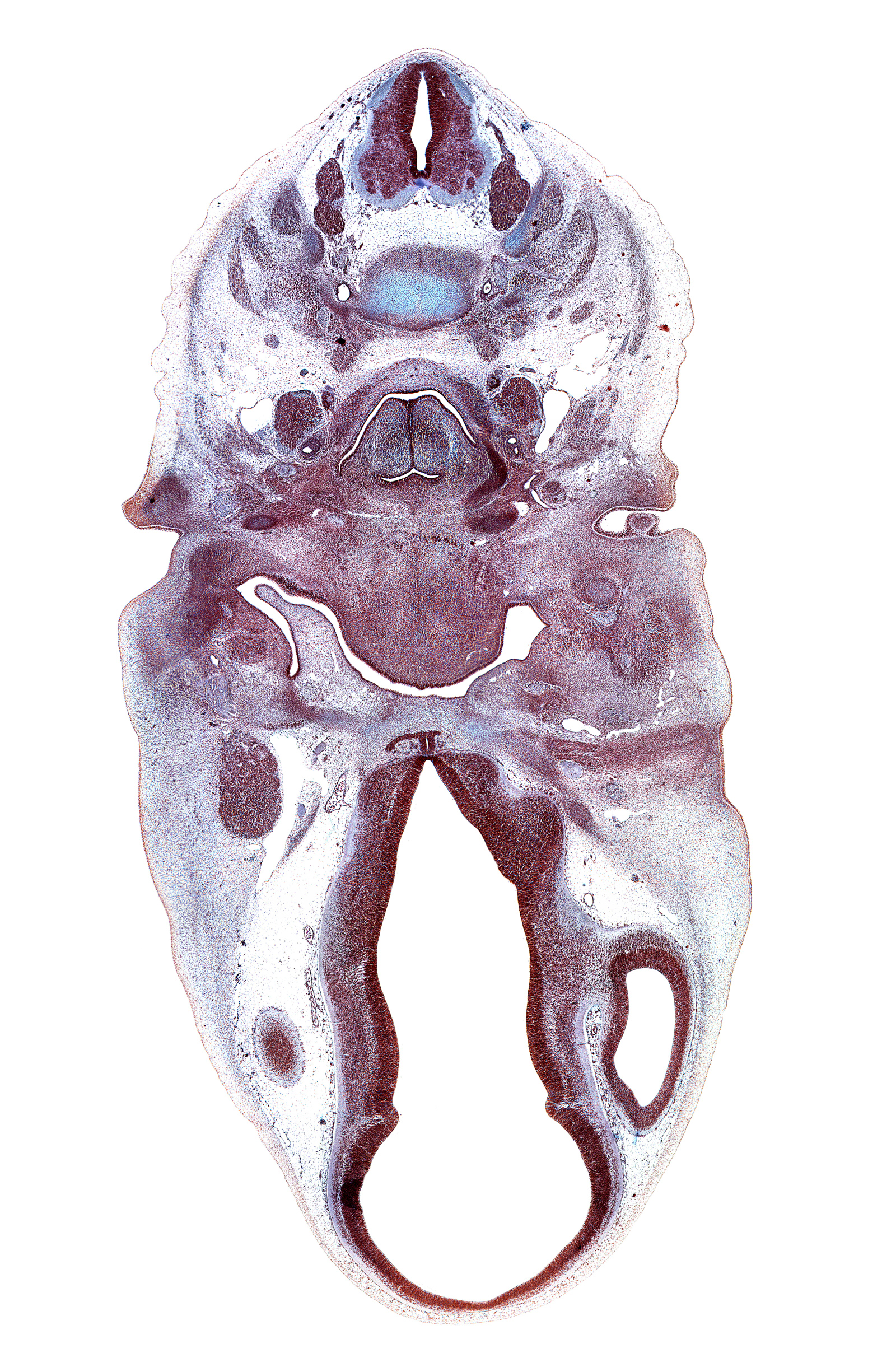 C-4 spinal nerve, C-5 dorsal root, C-5 spinal ganglion, caudal edge of adenohypophysis, central canal, cerebral vesicle (telencephalon), cervical plexus, dorsal thalamus, edge of cerebral vesicle(s), external acoustic meatus, external carotid artery, fusion region between cerebral vesicle and diencephalon, hypothalamic sulcus, hypothalamus, internal carotid artery, laryngeal inlet, laryngeal pharynx, lateral rectus muscle, lateral ventricle, marginal ridge, maxillary nerve (CN V₂), middle cerebral artery, middle pharyngeal constrictor muscle, oculomotor nerve (CN III), ophthalmic nerve (CN V₁), orbitosphenoid, pharyngeal arch 2 cartilage, semispinalis capitis muscle, semispinalis cervicis muscle, splenius muscle, sternocleidomastoid muscle, trapezius muscle, ventral thalamus