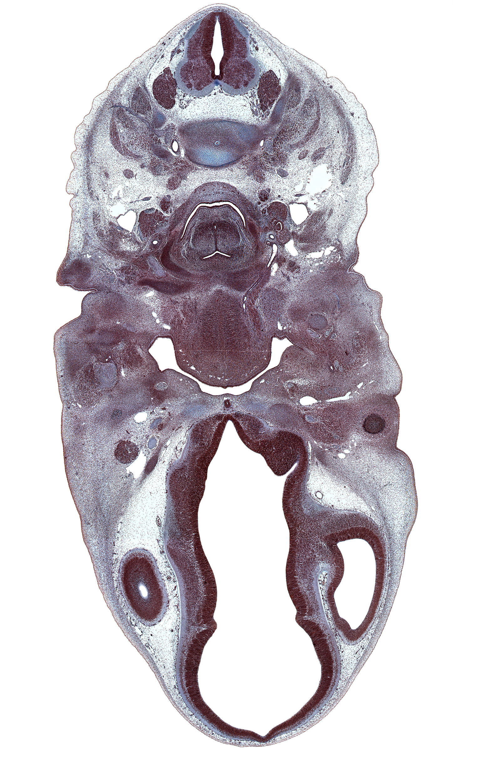 C-3 / C-4 intervertebral disc, C-4 spinal nerve, C-5 spinal ganglion, body of sphenoid, centrum of C-3 vertebra, cervical plexus, dorsal thalamus, edge of cerebral vesicle(s), edge of lateral ventricle, edge of pigmented layer of retina, epithalamus, hypothalamus, jugular lymph sac, laryngeal pharynx, lingual artery, mandibular nerve (CN V₃), marginal ridge, maxillary nerve (CN V₂), nasopharynx, neural arch of C-4 vertebra, ophthalmic nerve (CN V₁), optic groove, orbitosphenoid, pharyngeal arch 3 cartilage, precardinal vein (internal jugular vein), primordial mandible, pterygopalatine ganglion, splenius muscle, stem of adenohypophysis, sternocleidomastoid muscle, trapezius muscle, ventral thalamus, zona limitans intrathalamica