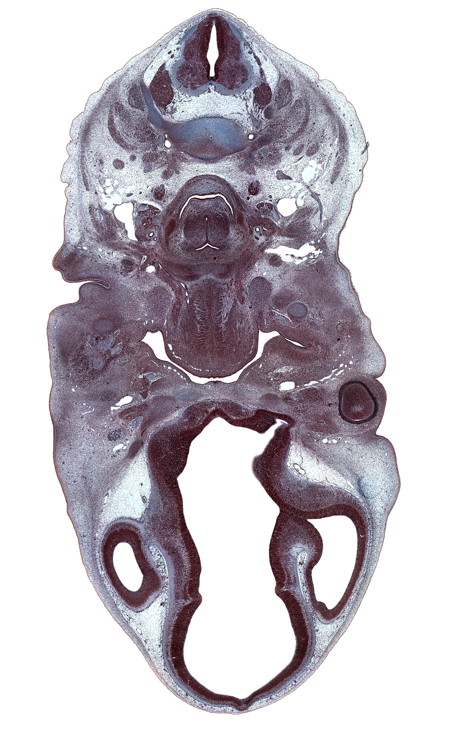 C-3 / C-4 intervertebral disc, C-4 spinal nerve, C-5 spinal ganglion, centrum of C-4 vertebra, cornea, dorsal root(s), external carotid artery, fusion region between cerebral vesicle and diencephalon, hypoglossal nerve (CN XII), hypoglossus muscle blastema, internal carotid artery, jugular lymph sac, laryngeal condensation, laryngeal pharynx, lateral ventricle, marginal ridge, maxillary venous plexus, middle cerebral artery, neural arch of C-5 vertebra, optic chiasma (chiasmatic plate), orbitosphenoid, origin of optic nerve (CN II), posterior digastric muscle blastema, roof plate of diencephalon, sternocleidomastoid muscle, submandibular groove, supraclavicular nerve, trapezius muscle, upper eyelid, ventral root, zona limitans intrathalamica