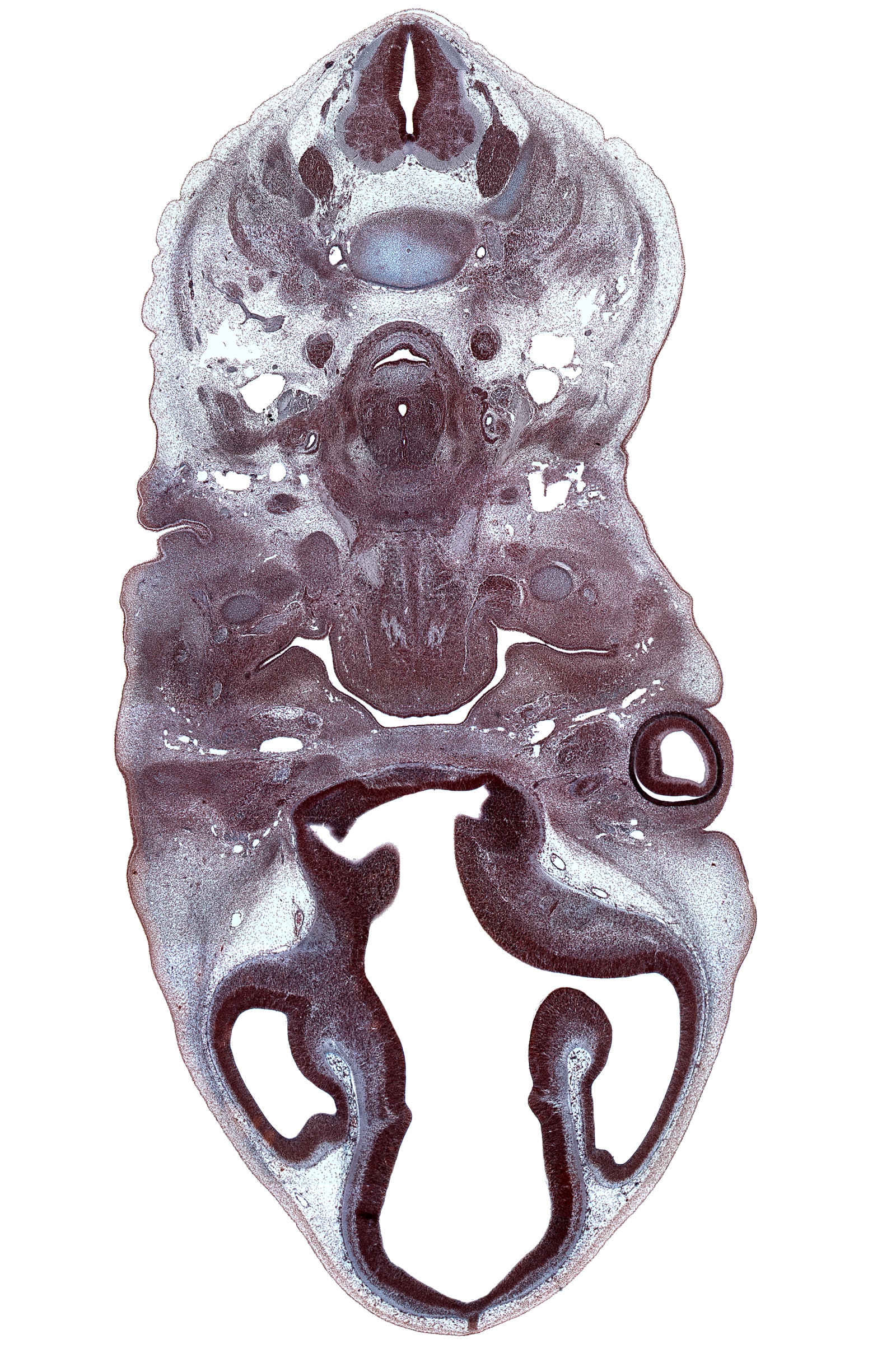 C-4 / C-5 intervertebral disc, C-5 spinal nerve, C-6 dorsal root, C-6 spinal ganglion, centrum of C-4 vertebra, cerebral vesicle (telencephalon), ciliary ganglion, cornea, dorsal thalamus, epithalamus, external acoustic meatus, fusion region between cerebral vesicle and diencephalon, hyoid body condensation, hypothalamus (diencephalon), inferior pharyngeal constrictor muscle, interventricular foramen, intraretinal space (optic vesicle cavity), jugular lymph sac, lateral ventricle, marginal ridge, maxillary venous plexus, ophthalmic nerve (CN V₁), optic cup cavity, optic nerve (CN II), optic ventricle, parotid gland bud, pineal bud, precardinal vein (internal jugular vein), splenius muscle, submandibular ganglion, submandibular gland bud, trapezius muscle, ventral thalamus (diencephalon)